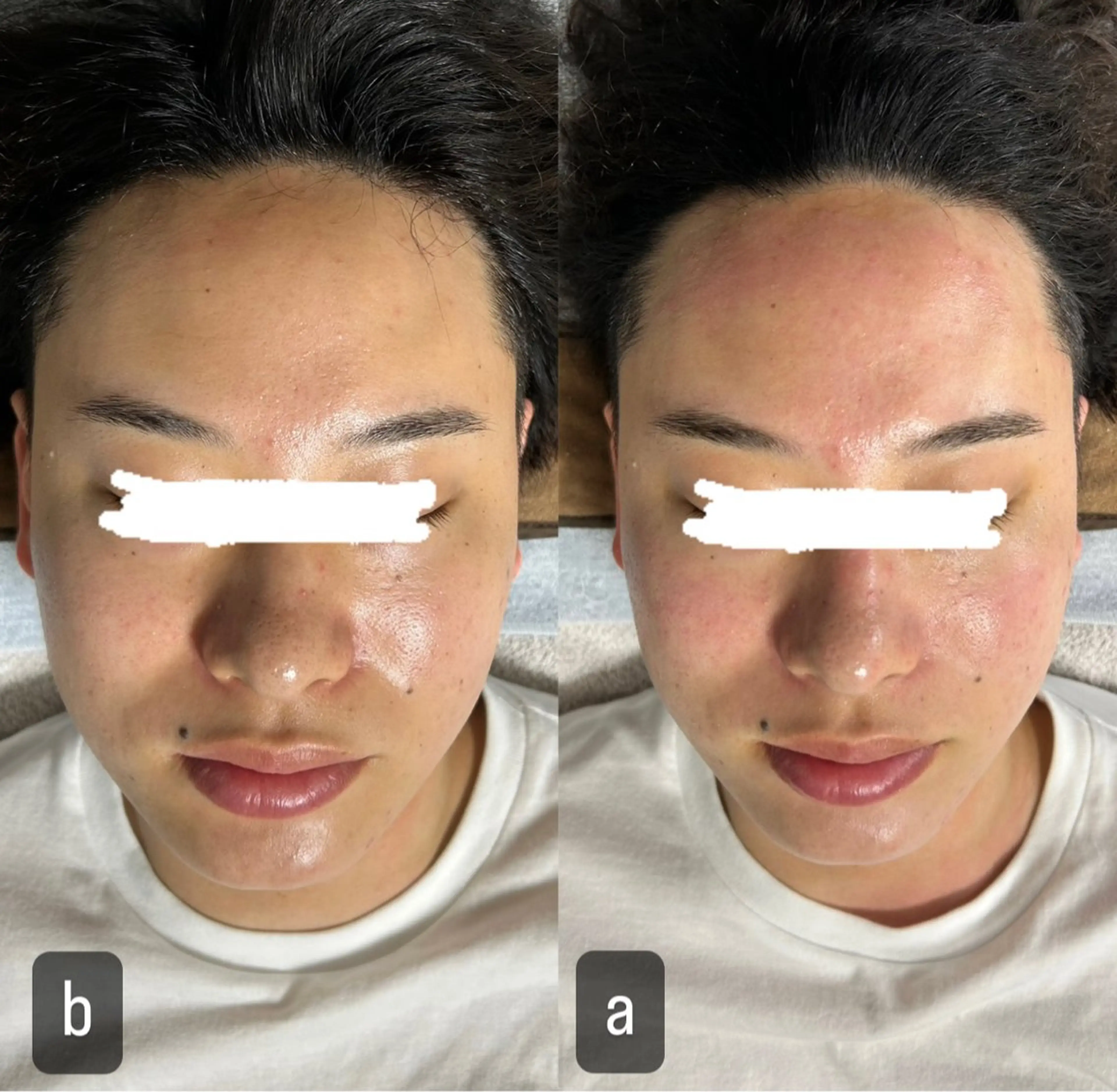 217 ホワイトニングルームのエステ・リラクイメージ