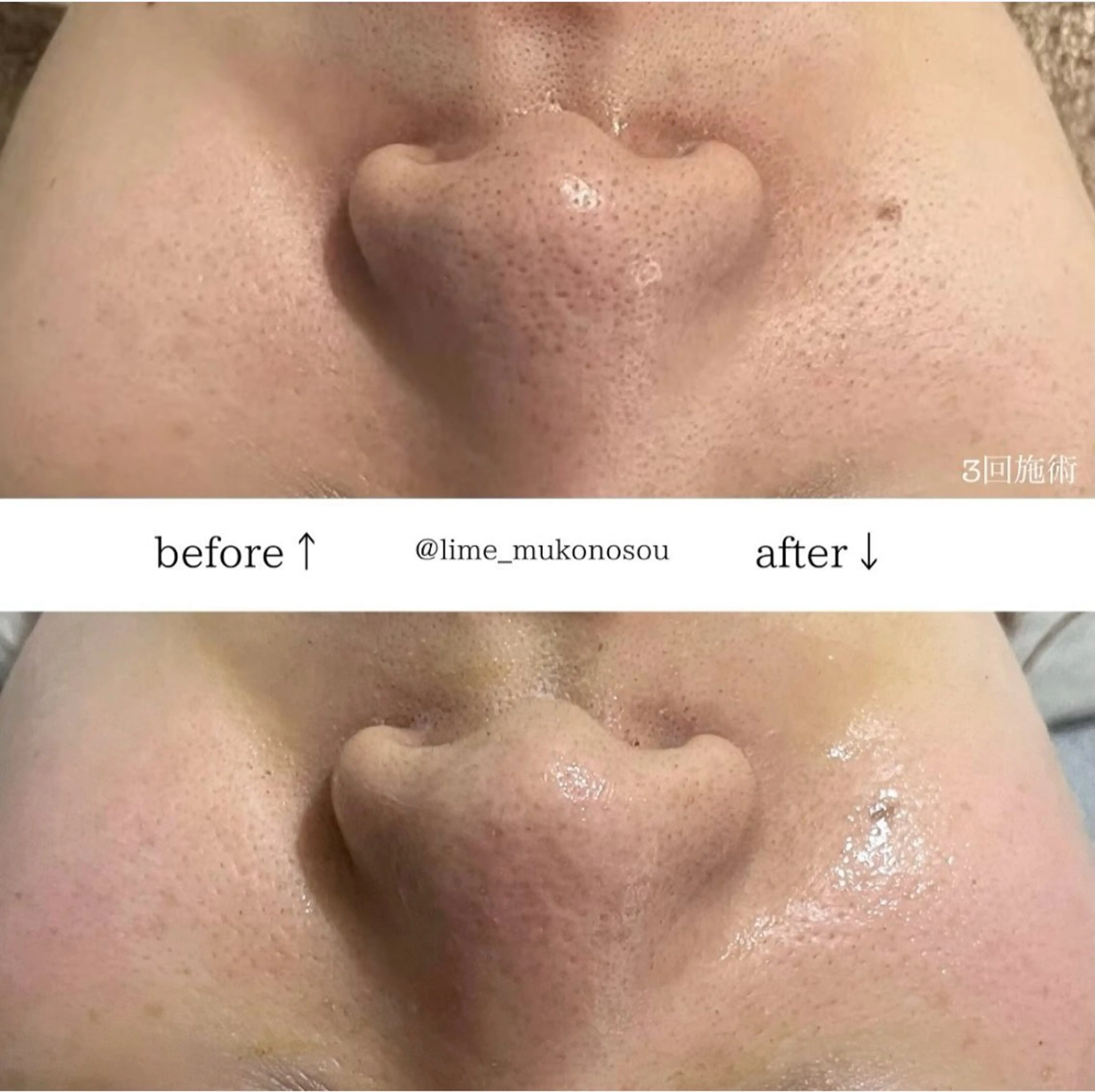 LIME 武庫之荘店のエステ・リラクイメージ