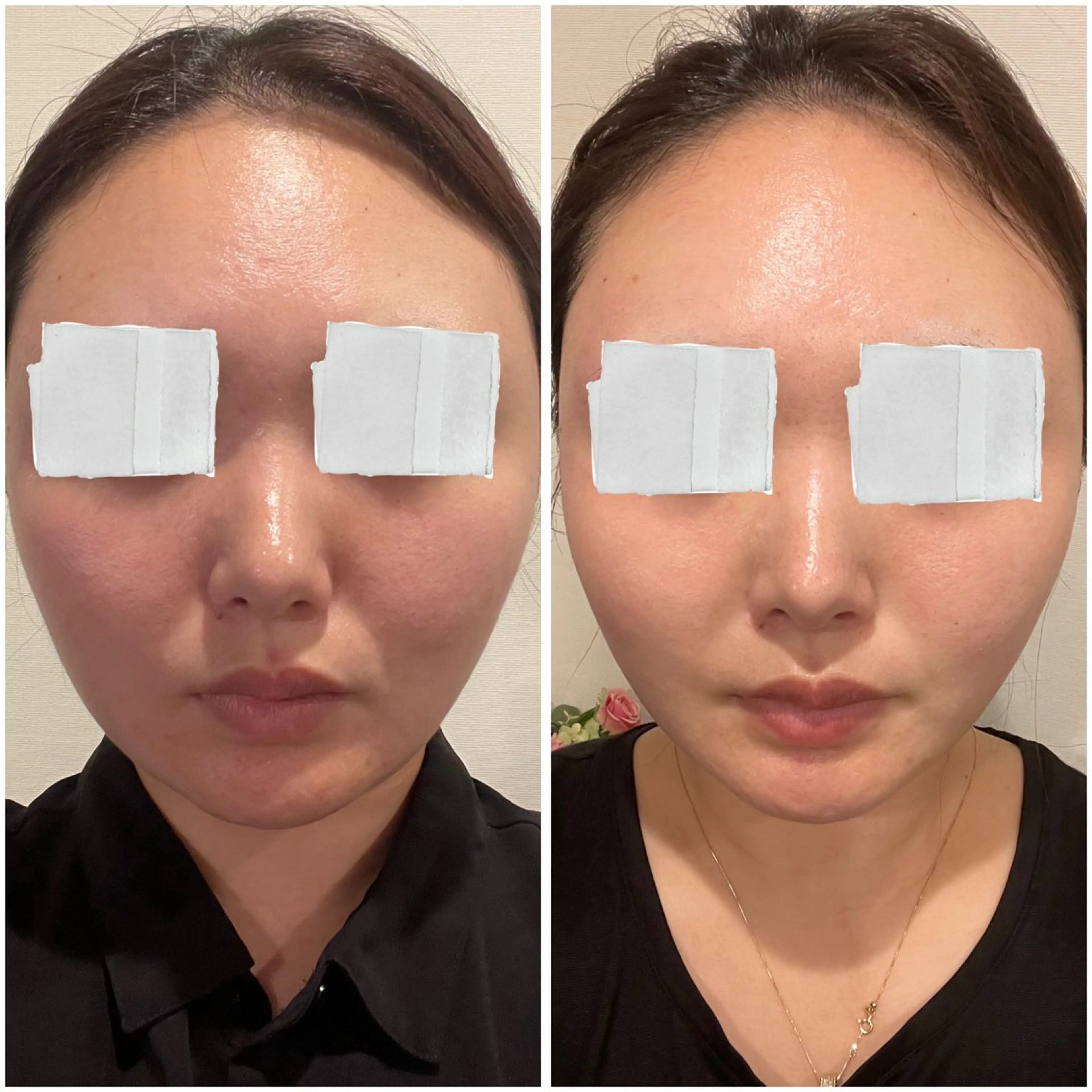 エステ 中尾 朱里のエステ・リラクイメージ