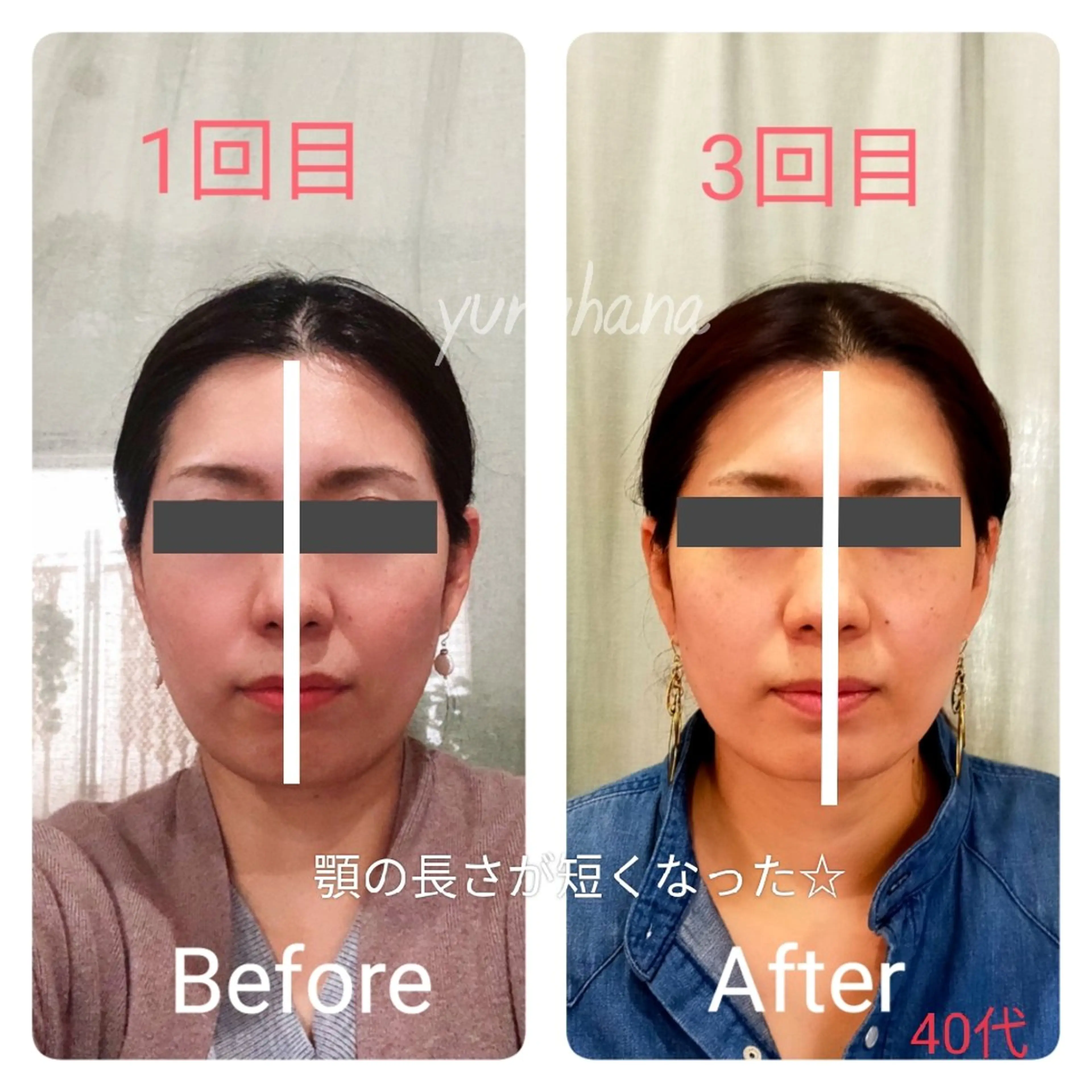 小顔矯正&足つぼサロン　yuruhana所属・小顔矯正&足つぼ yuruhanaのエステ・リラクイメージ