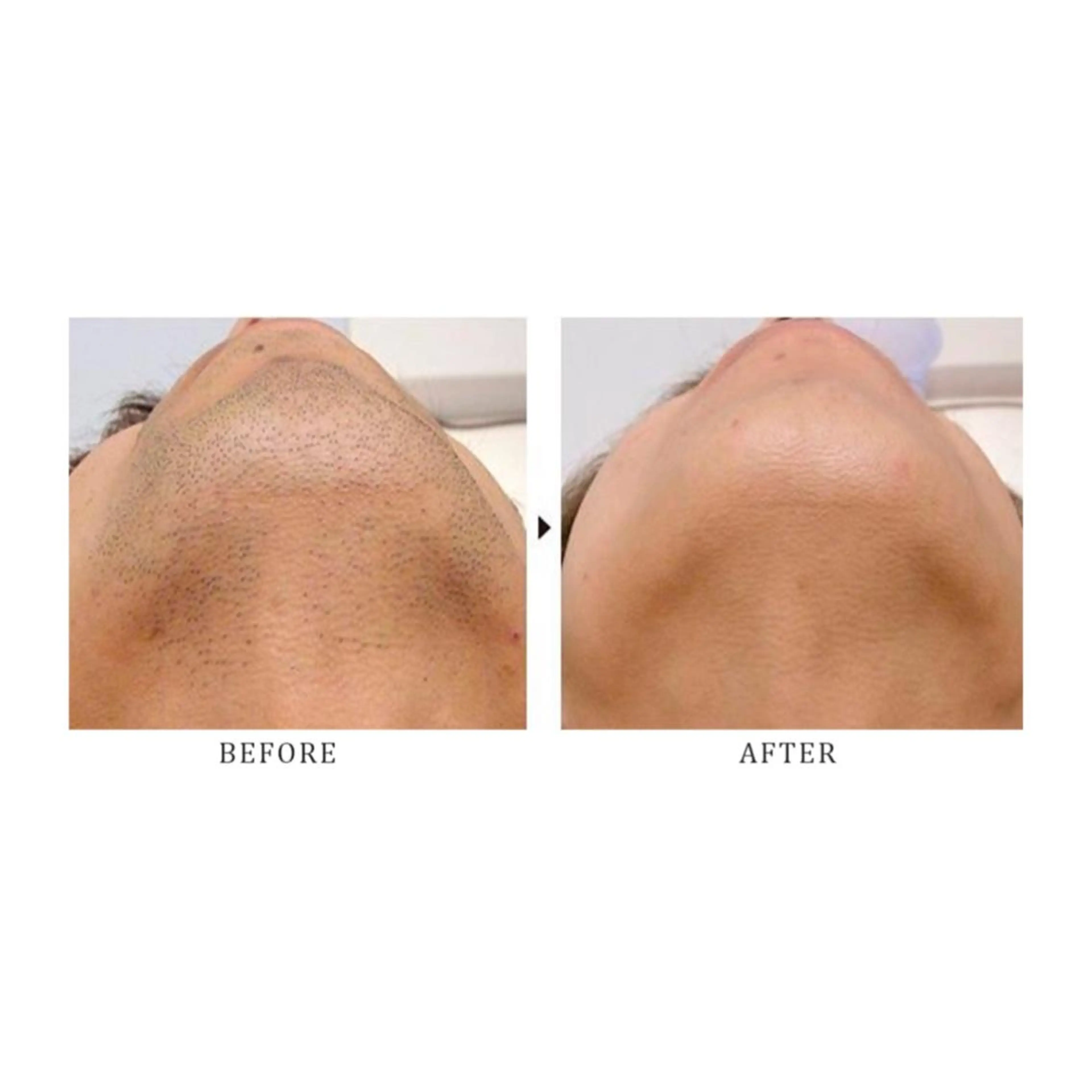 メンズ 脱毛 Puki Puki 脱毛サロンのエステ・リラクイメージ