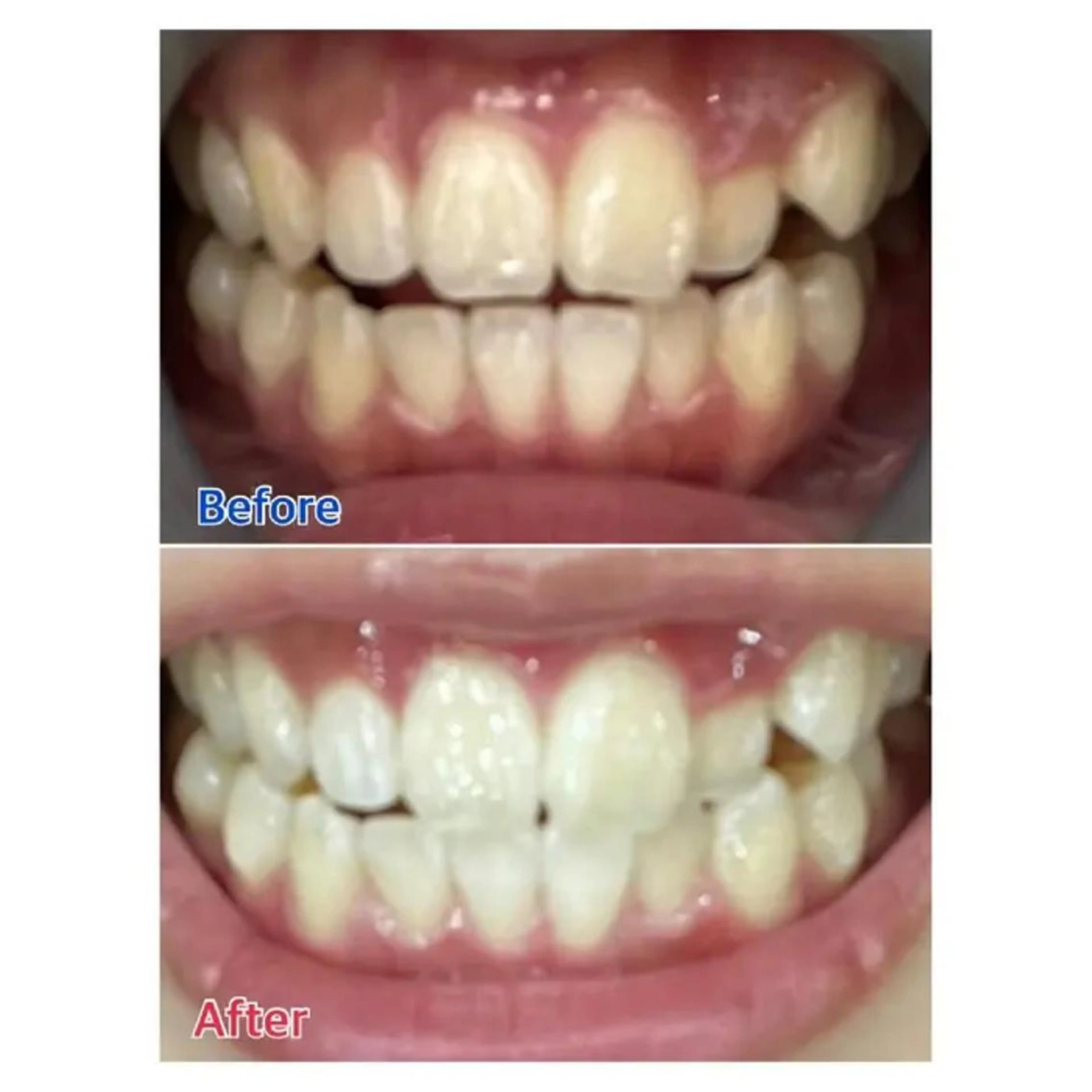 M渋谷 ホワイトニングのその他イメージ