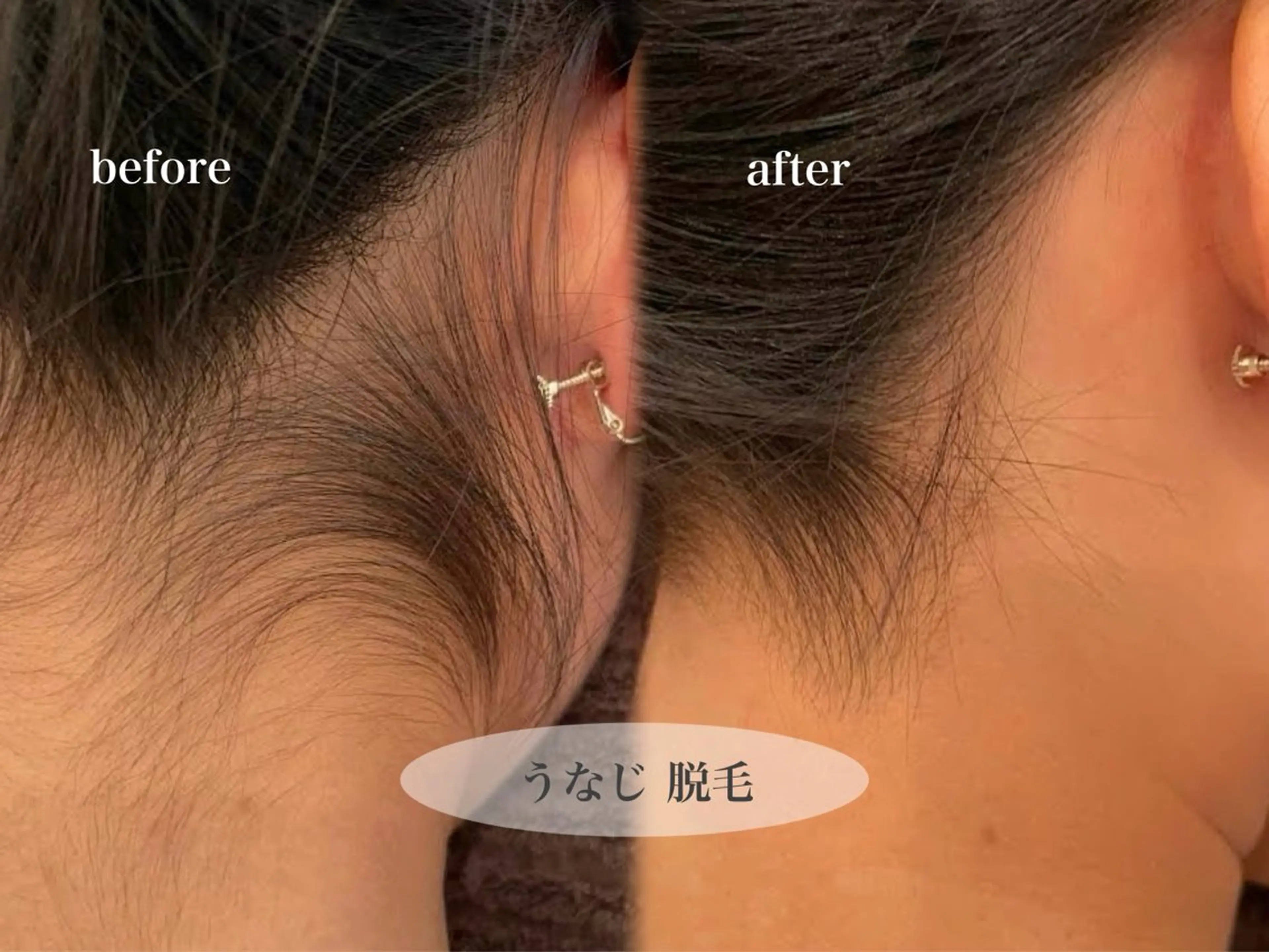 脱毛 金田 真菜美のエステ・リラクイメージ