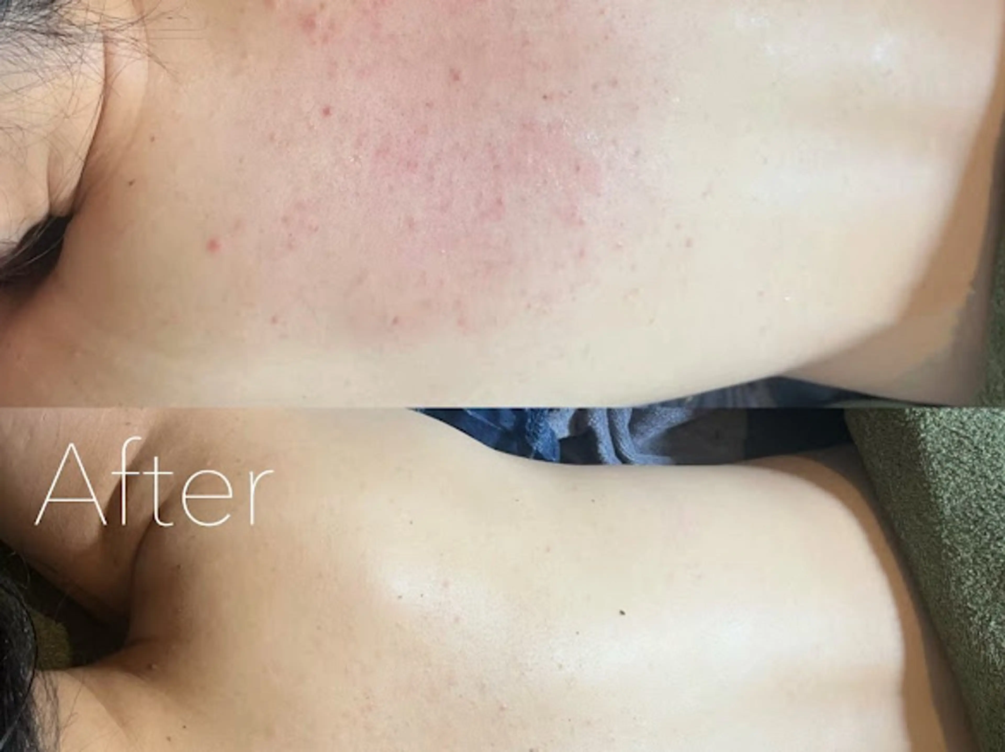 エステ 韓国肌管理Belle 神戸元町のエステ・リラクイメージ