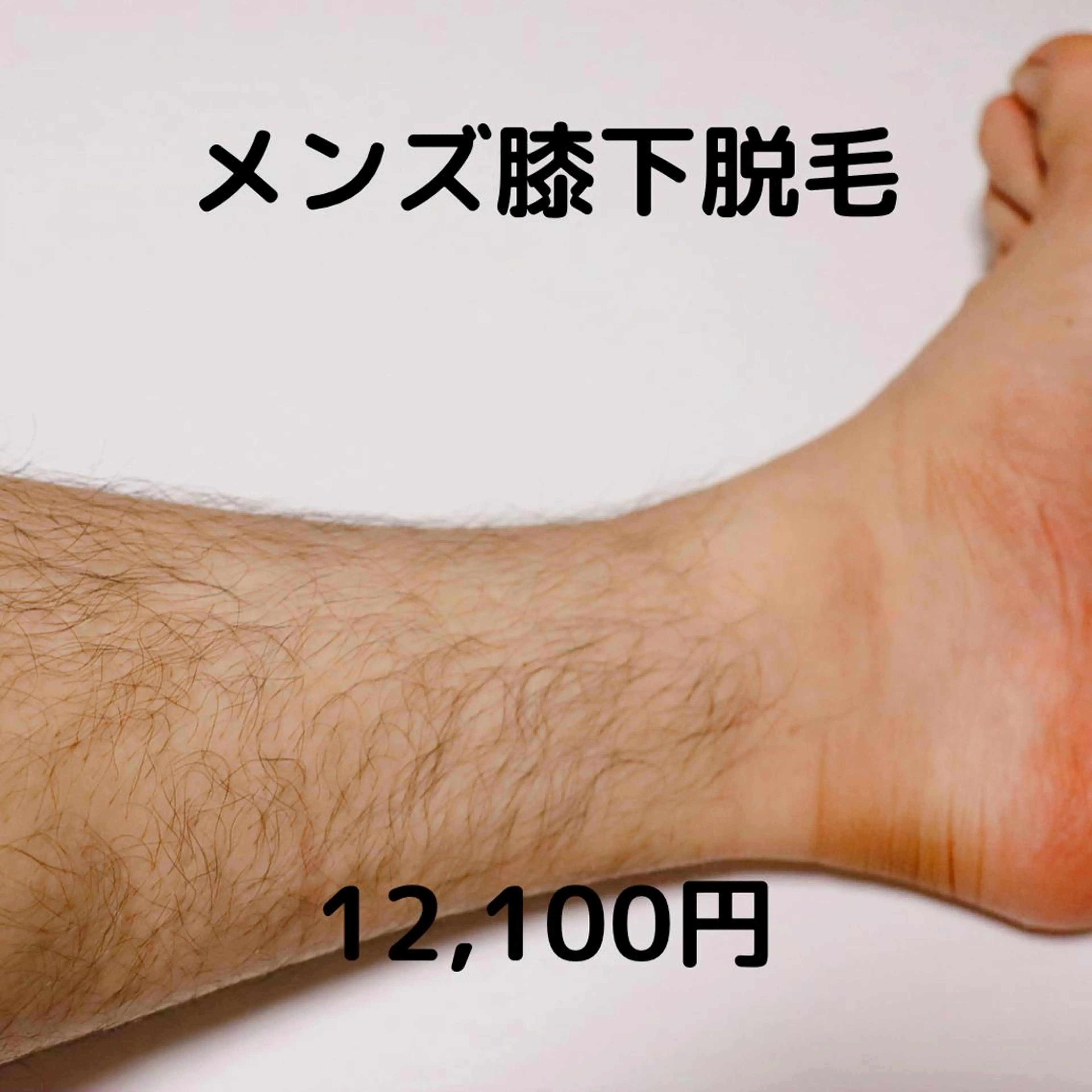 【清潔感UP★快適メンズ脱毛】短パンをスマートに履きたい方◎【膝下＆足指甲】1回回数：1回の写真