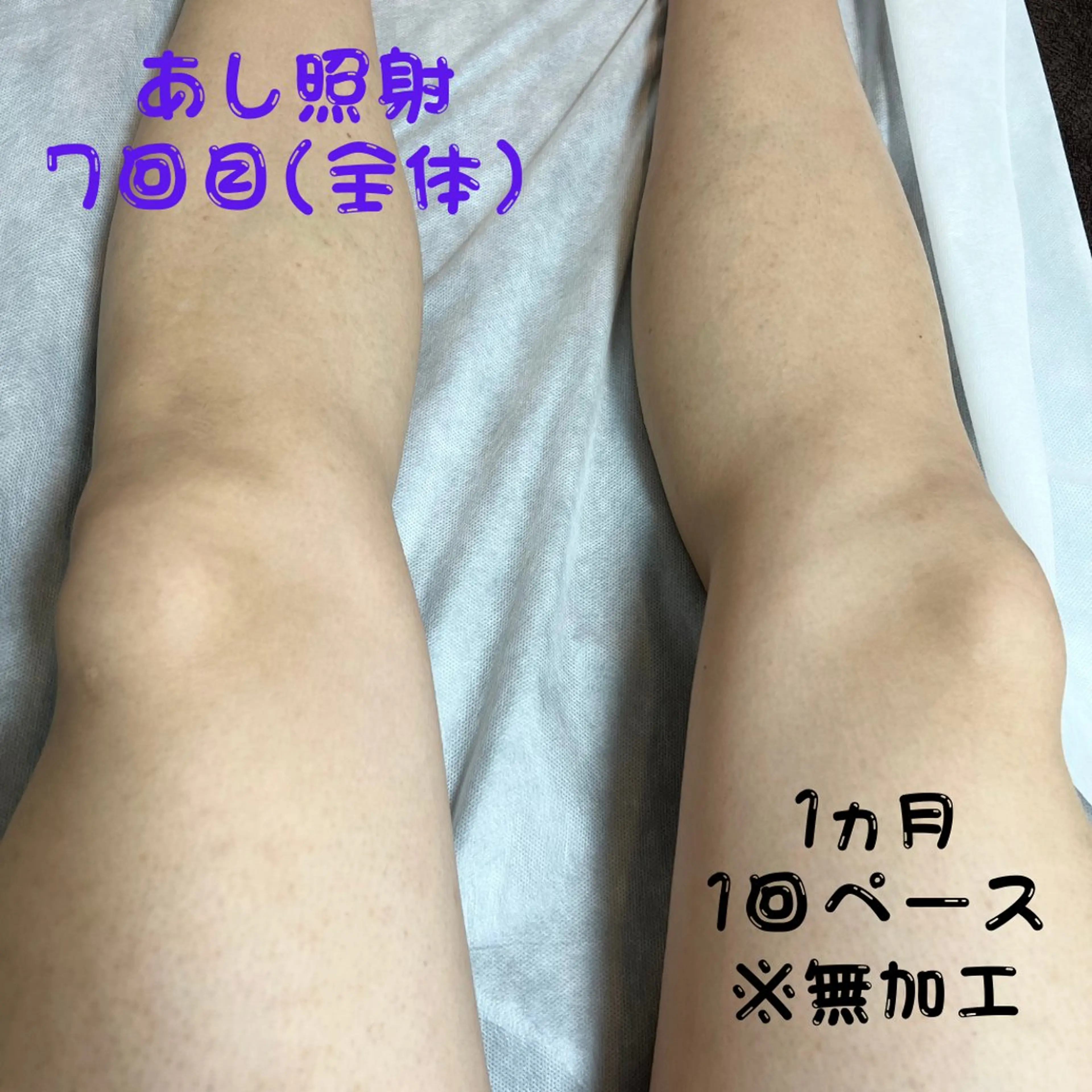 メンズ キッズ 脱毛 メンズ脱毛フェリッセ /男女🆗キッズ🆗のエステ・リラクイメージ