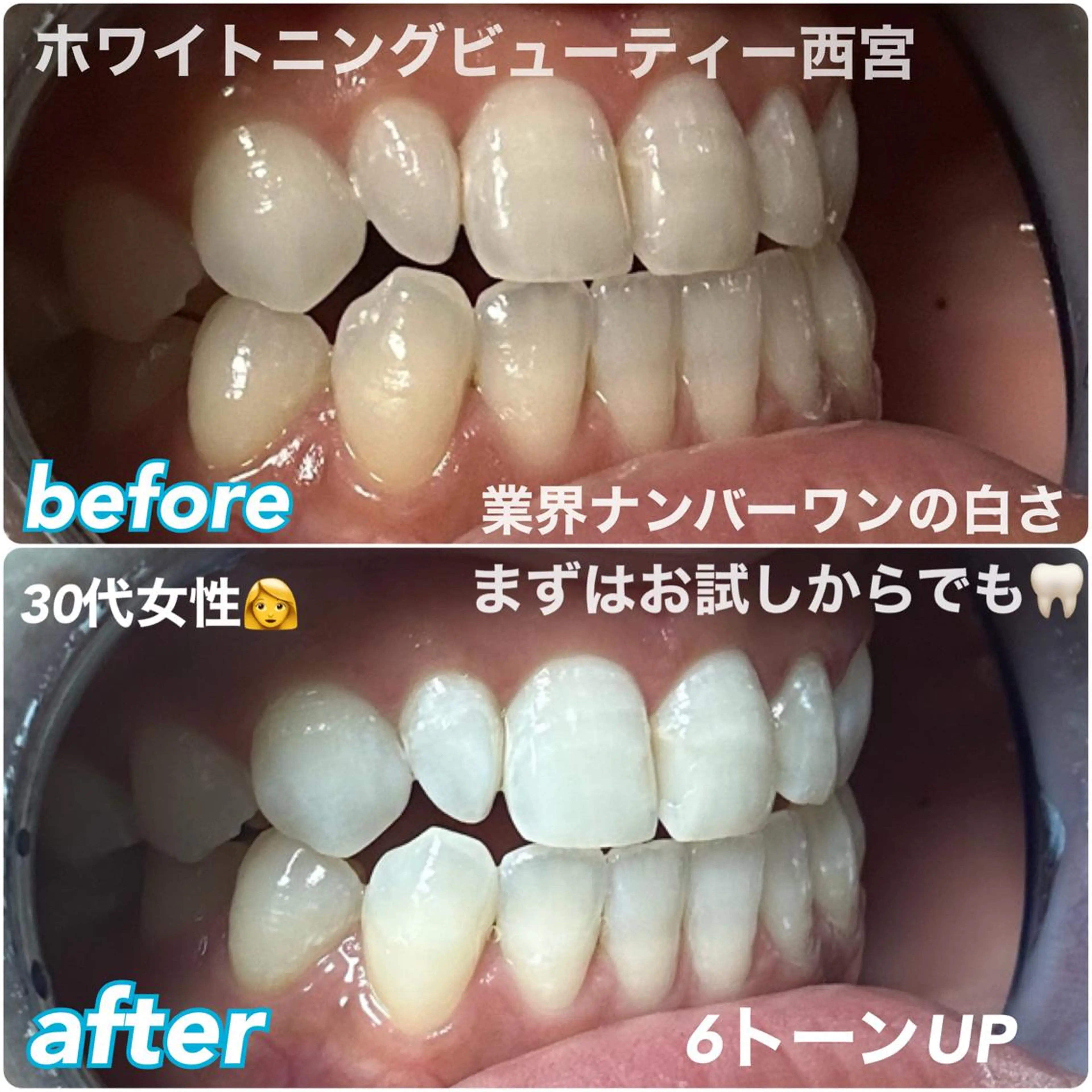 ホワイトニングビューティー西宮店所属・ホワイトニングビュー ティー西宮店のその他イメージ