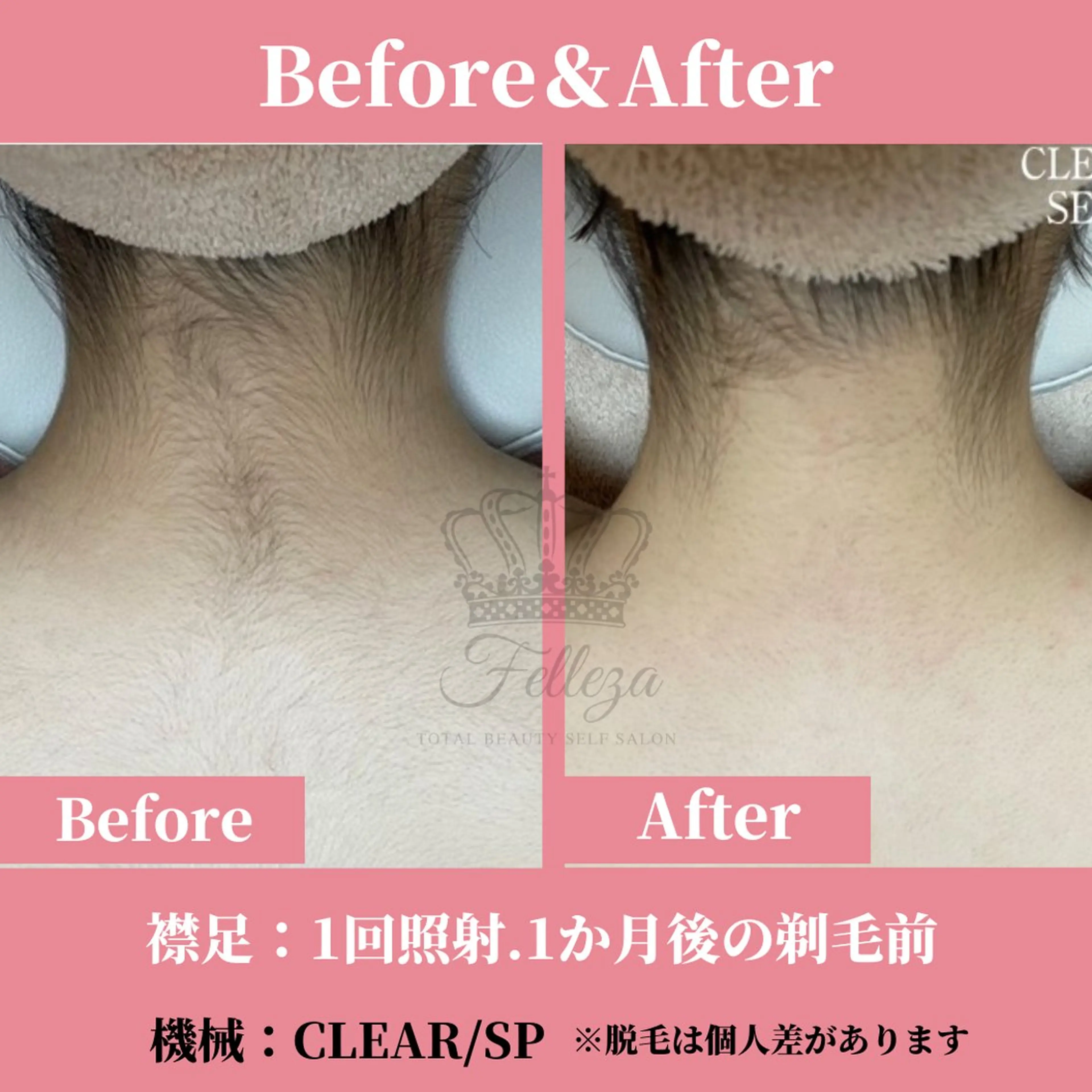 メンズ キッズ 有人型セルフサロン 脱毛／痩身／美顔のエステ・リラクイメージ