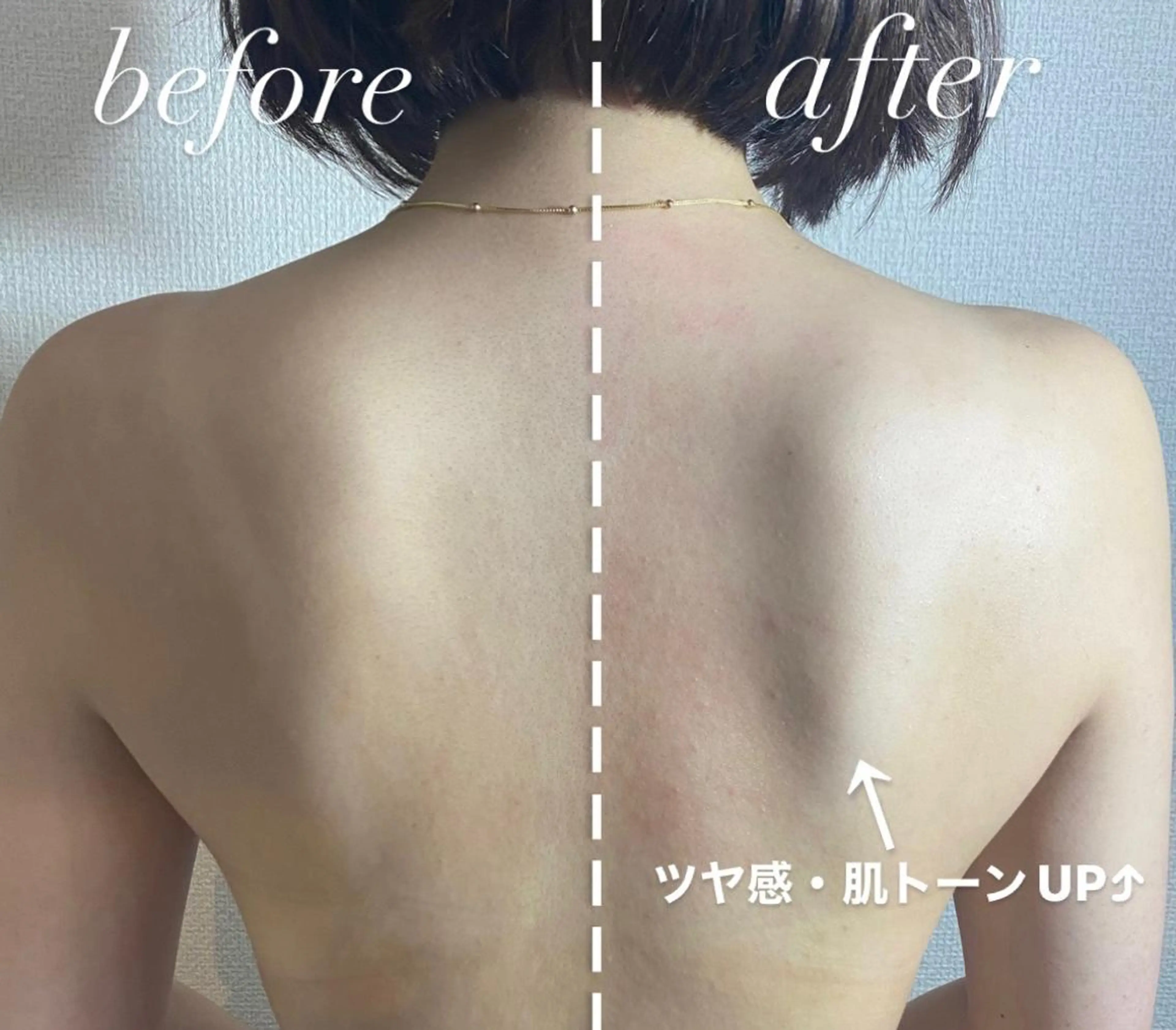 エピナス町田店 ブラジリアンワックスのエステ・リラクイメージ