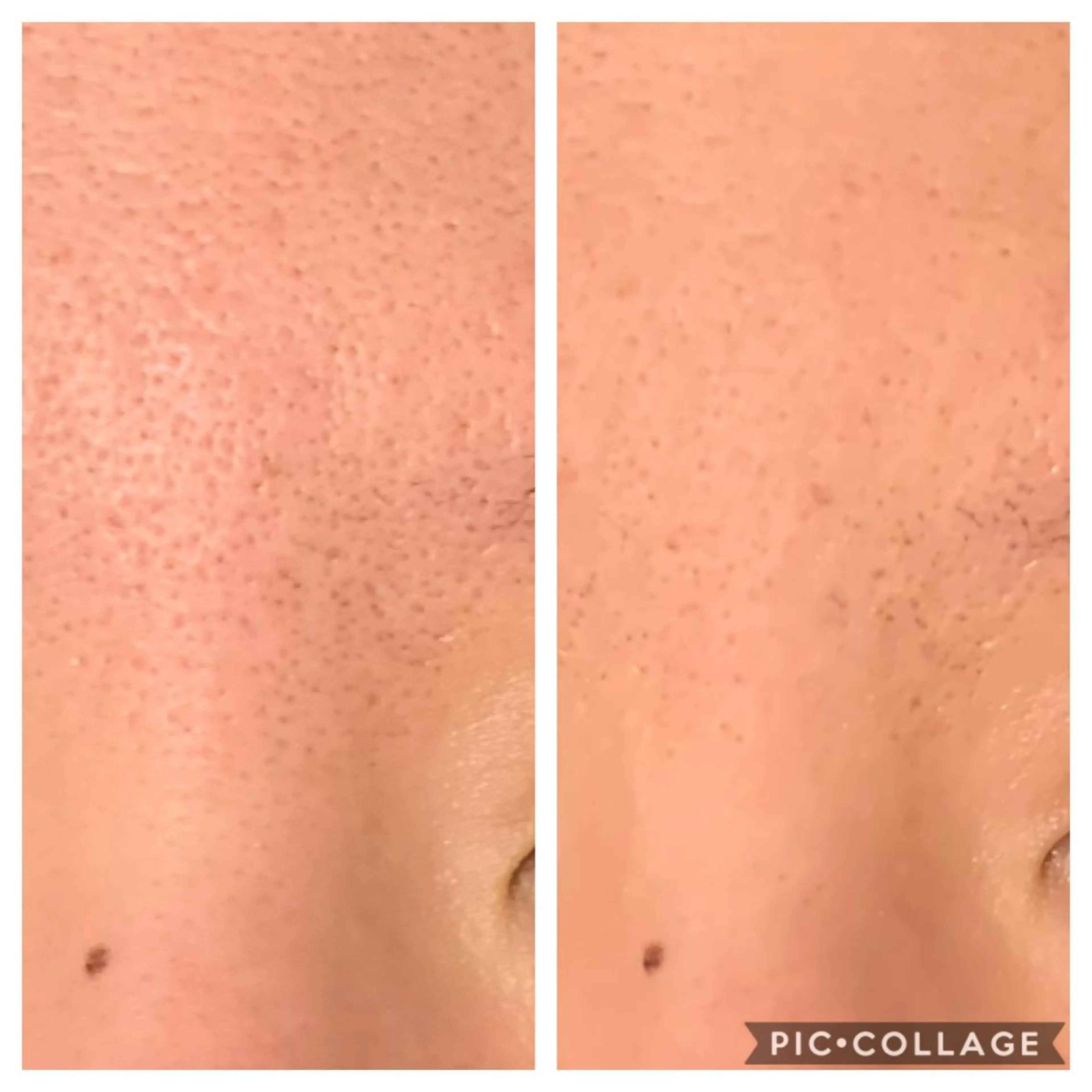 エステ 癒し腸もみサロン シャユーム　ゆきなのエステ・リラクイメージ