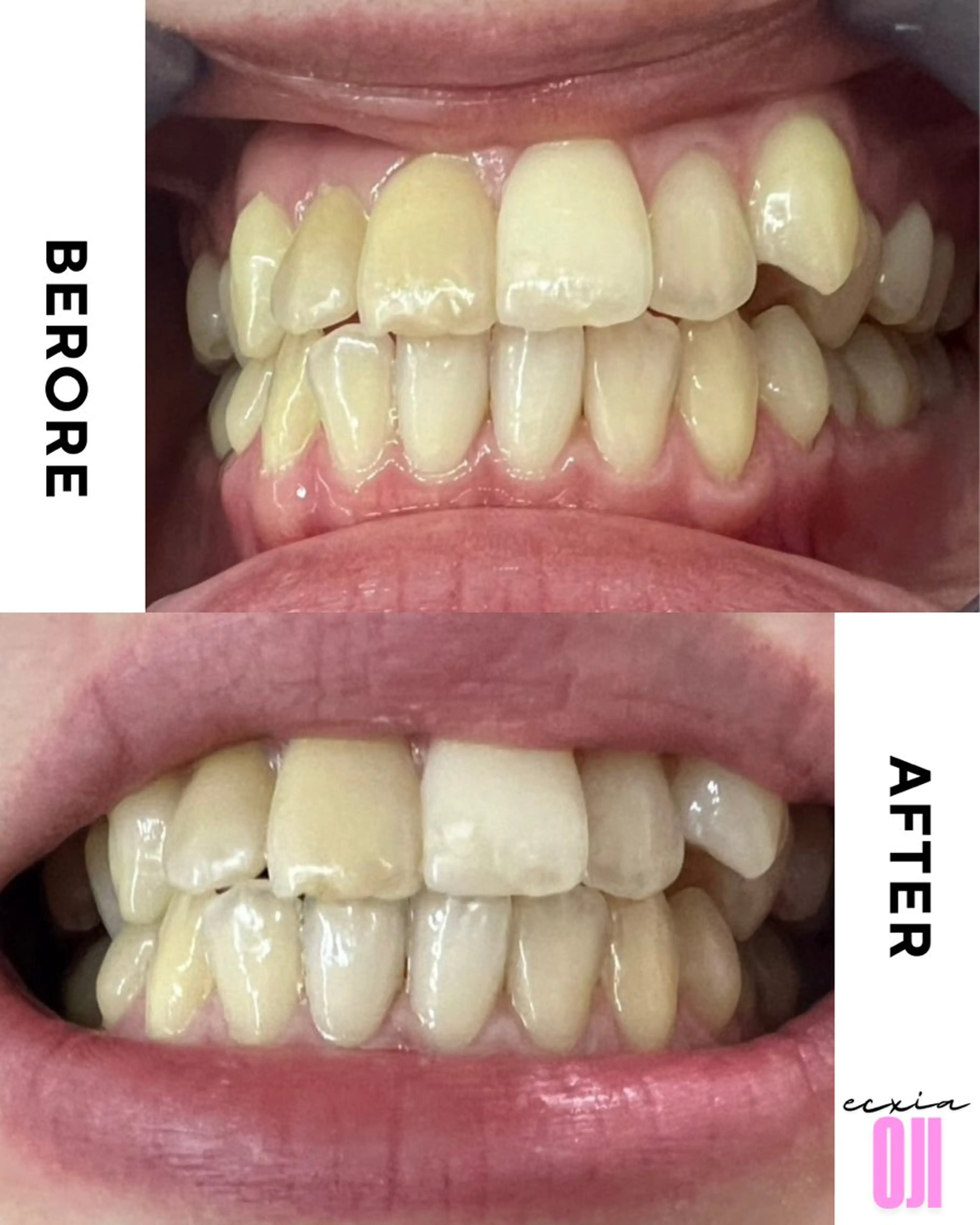 その他 セルフホワイトニングサロン  エクシアホワイト 王寺店所属・エクシア王寺 NISHIKAWAのその他イメージ