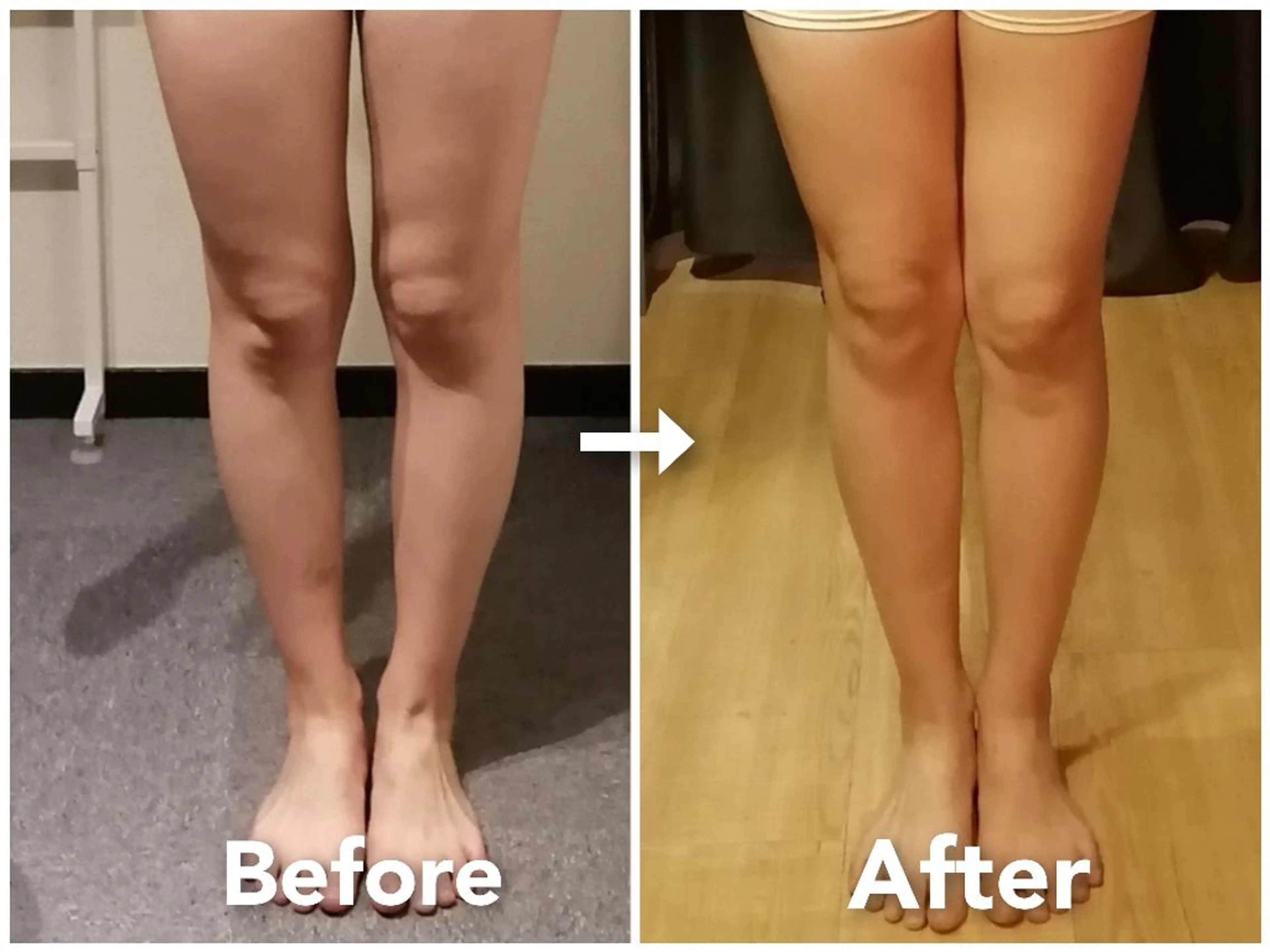 ✨学割U24✨【骨盤矯正】全身ダイエットや美脚効果❗骨盤の歪み/O脚/X脚/下半身太り/むくみ/腰痛/肩こり/パーソナルの写真