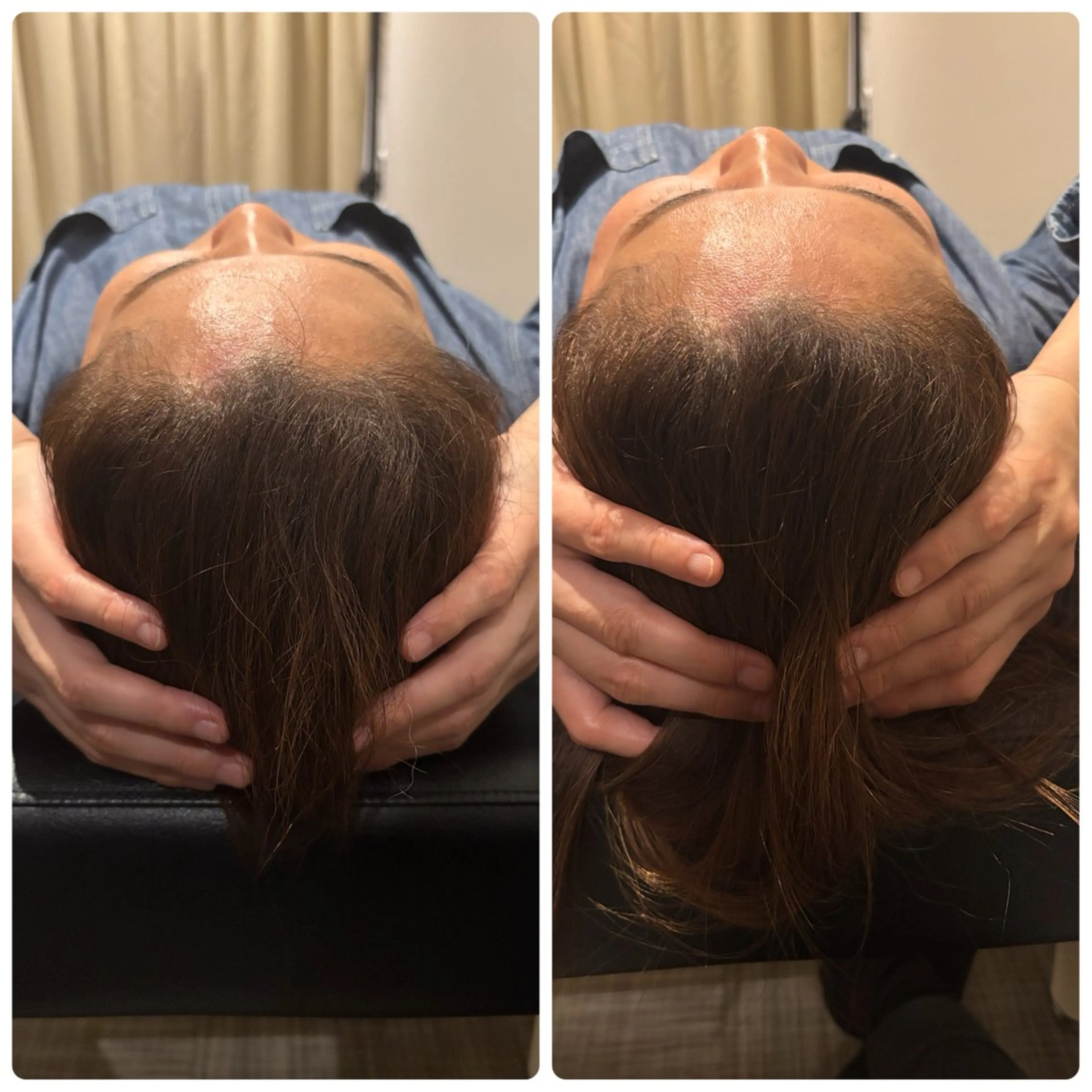 健康×美容鍼鍼灸院 あさば整体院三ノ輪店のエステ・リラクイメージ