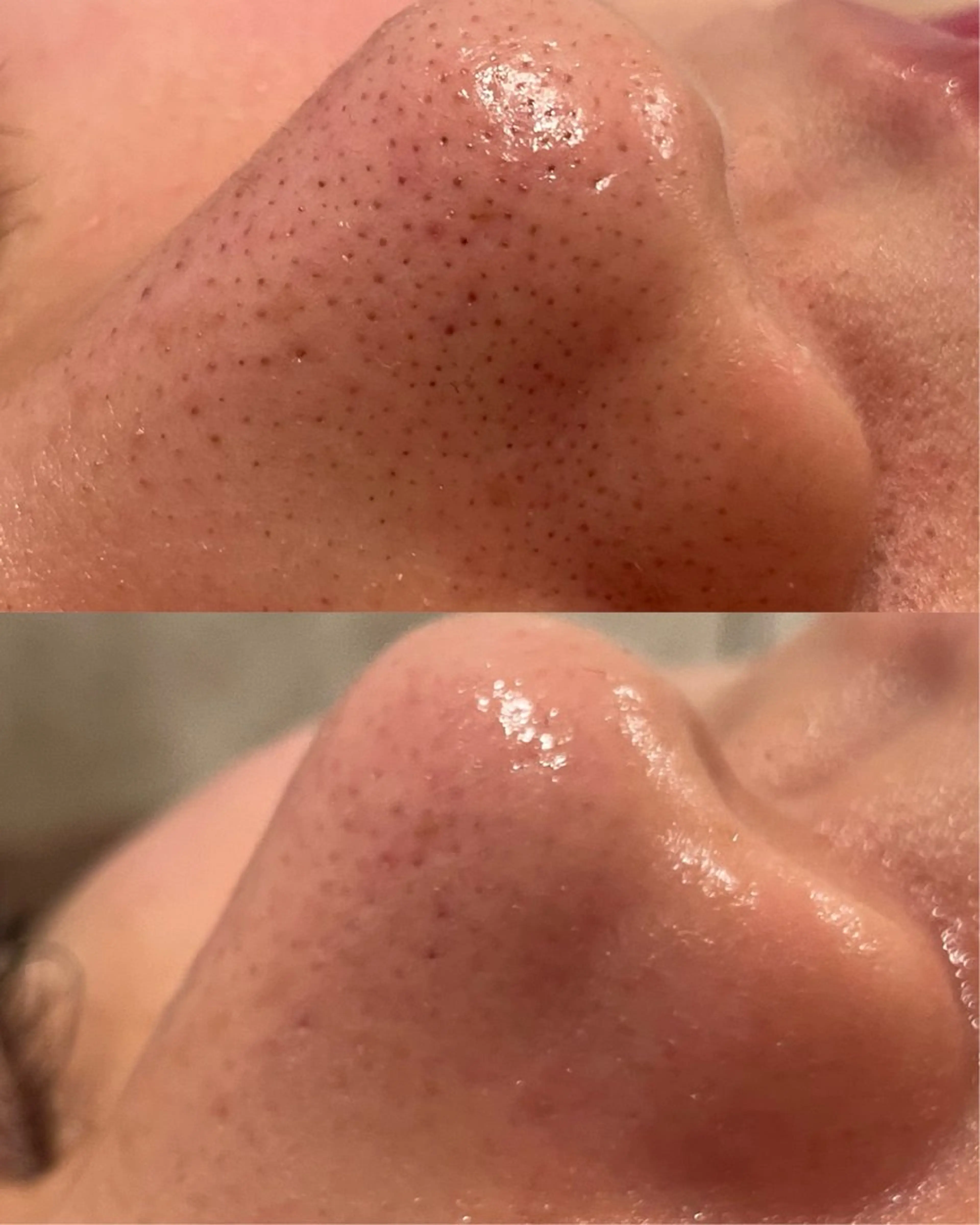 エステ La・Bellvie所属・La･Bellvie 【星ヶ丘店]のエステ・リラクイメージ