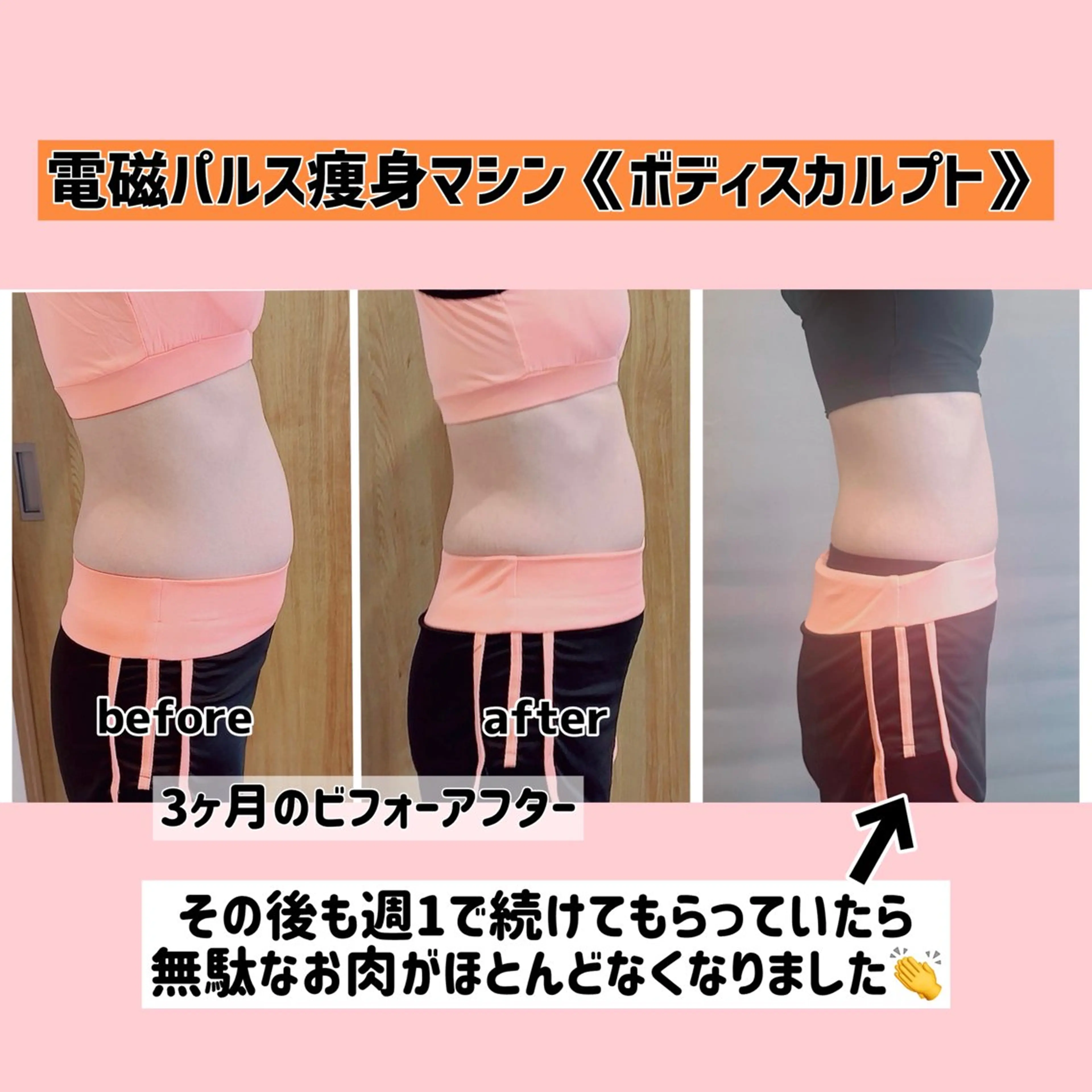 【写真モニター募集】電磁パルス痩身マシン《ボディスカルプト》4回（週一）の写真