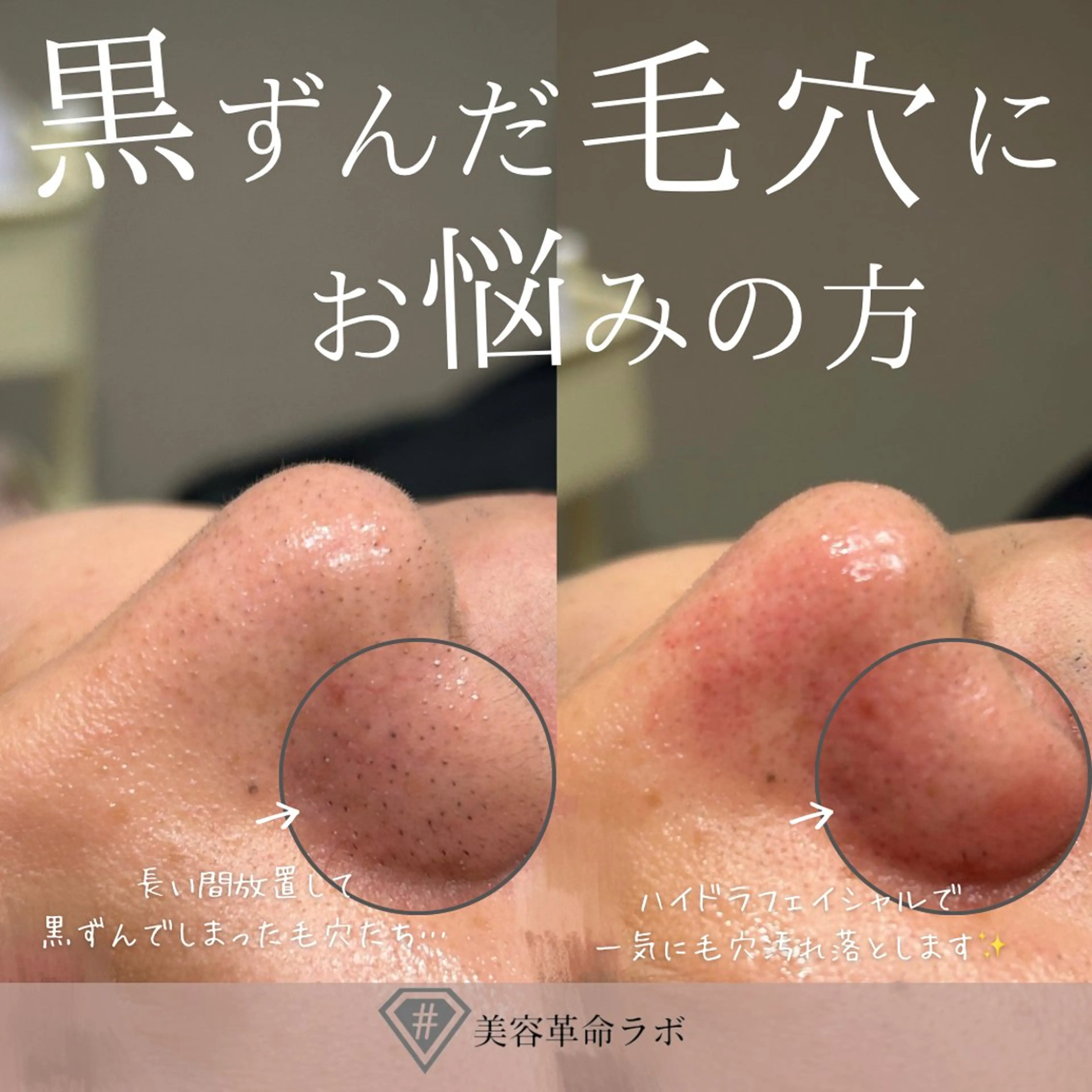 💎美容革命ラボ💎 大名店のエステ・リラクイメージ