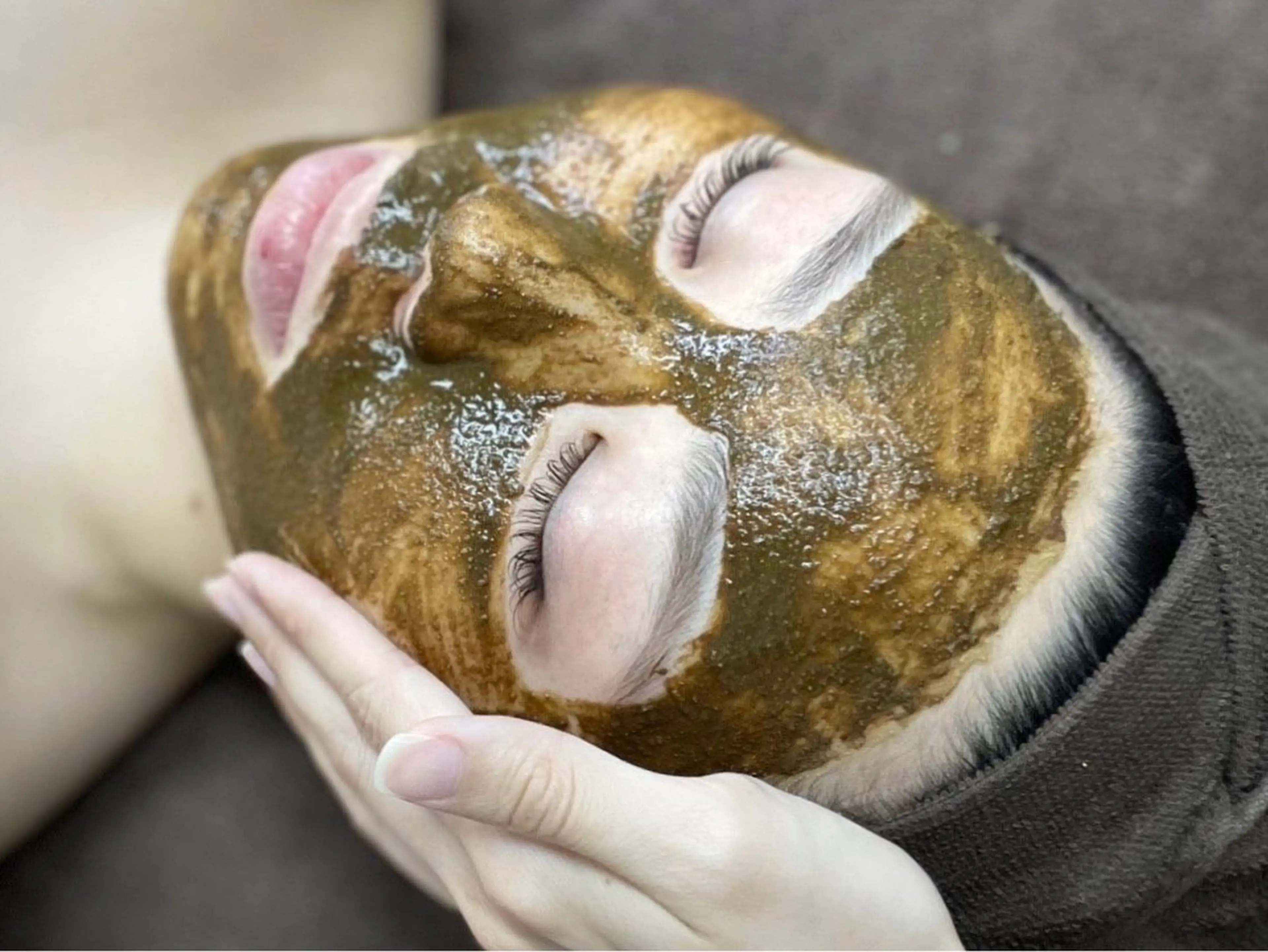 ハーブピーリング（顔）国産ハーブにこだわり、ドクターズハーブ使用。肌質改善　ワントーンアップ　ニキビでお悩みの方の写真