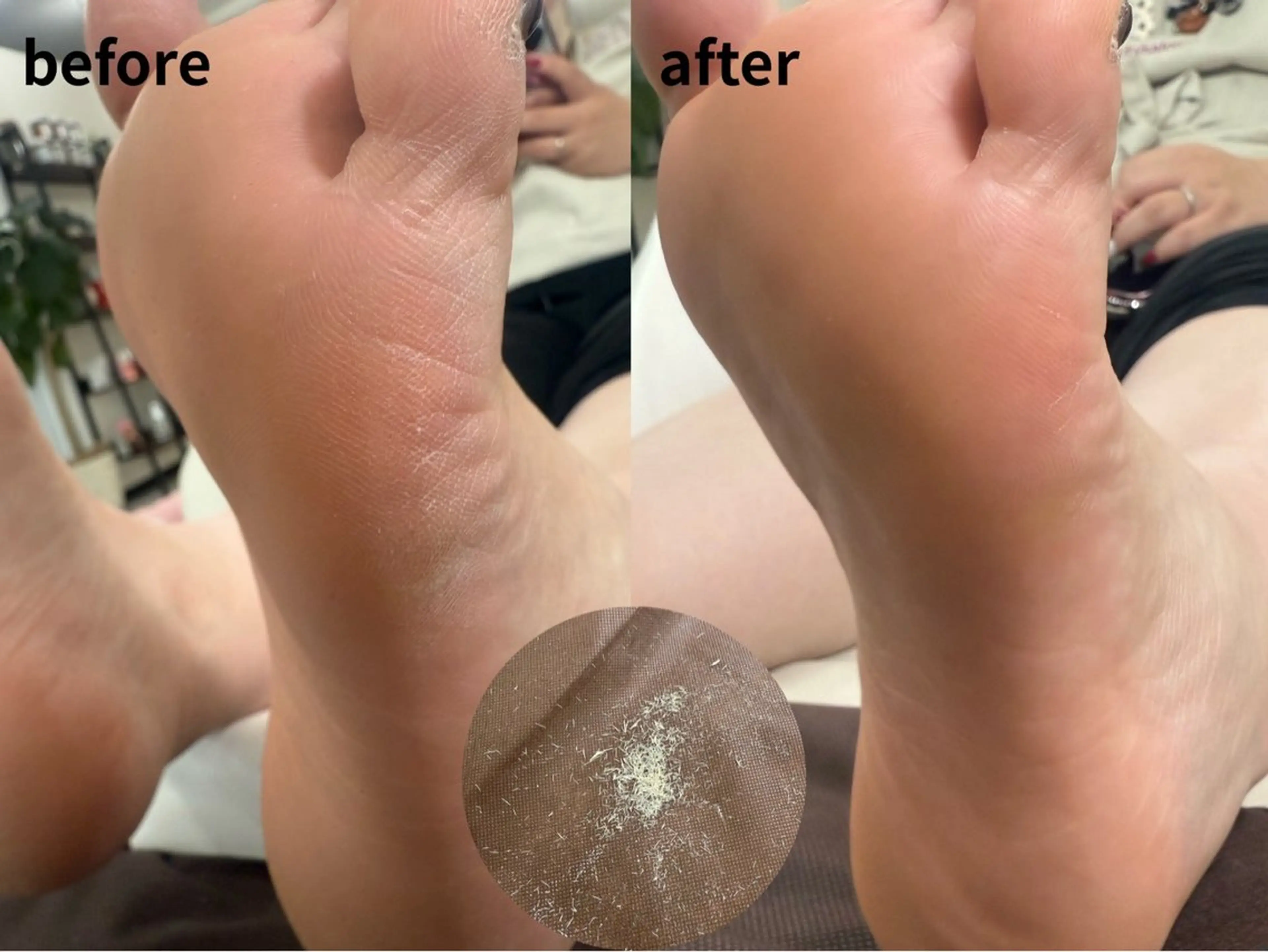 【フット】足裏角質ケア🫧の写真