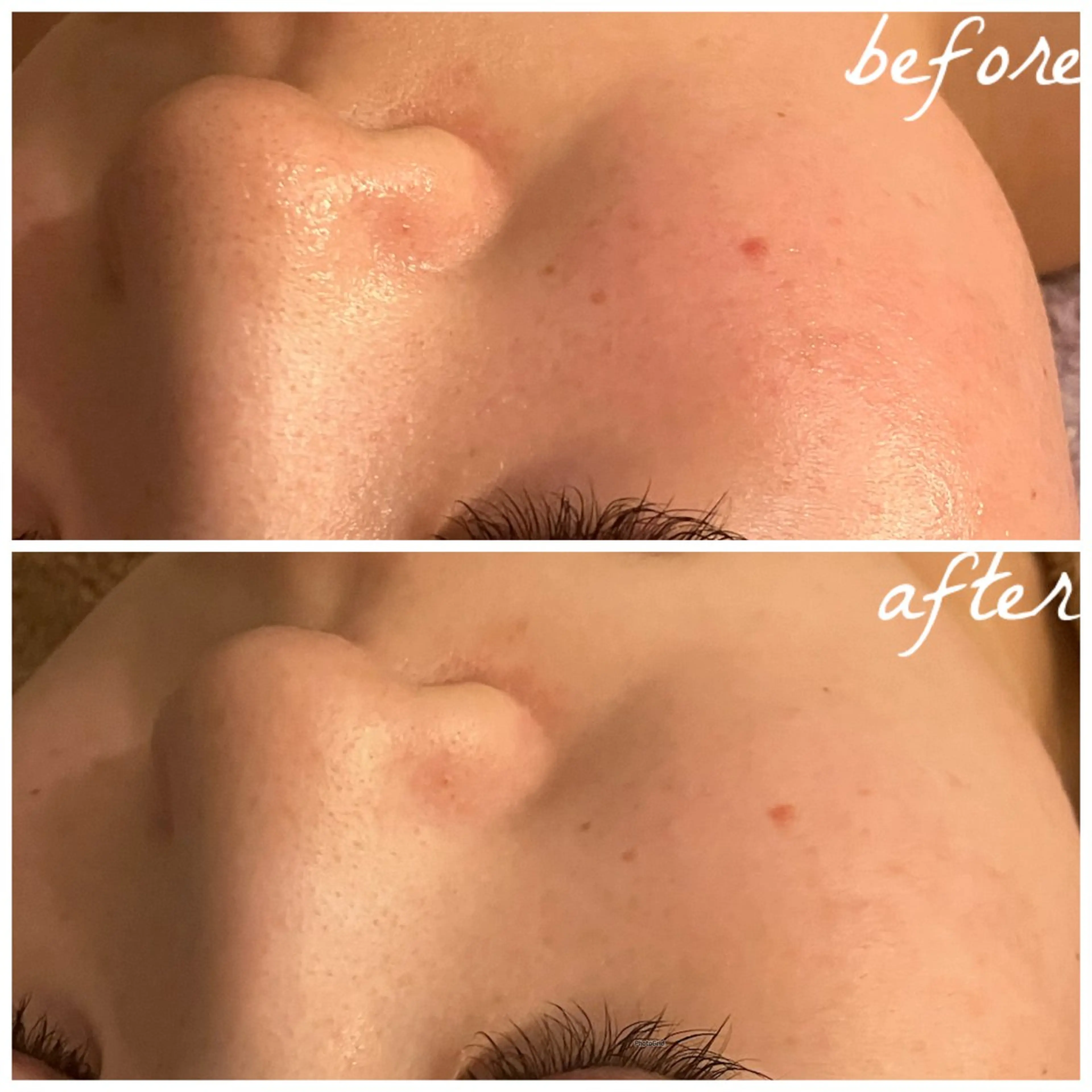 メンズ エステ メナード岐阜茜部 杉浦のエステ・リラクイメージ