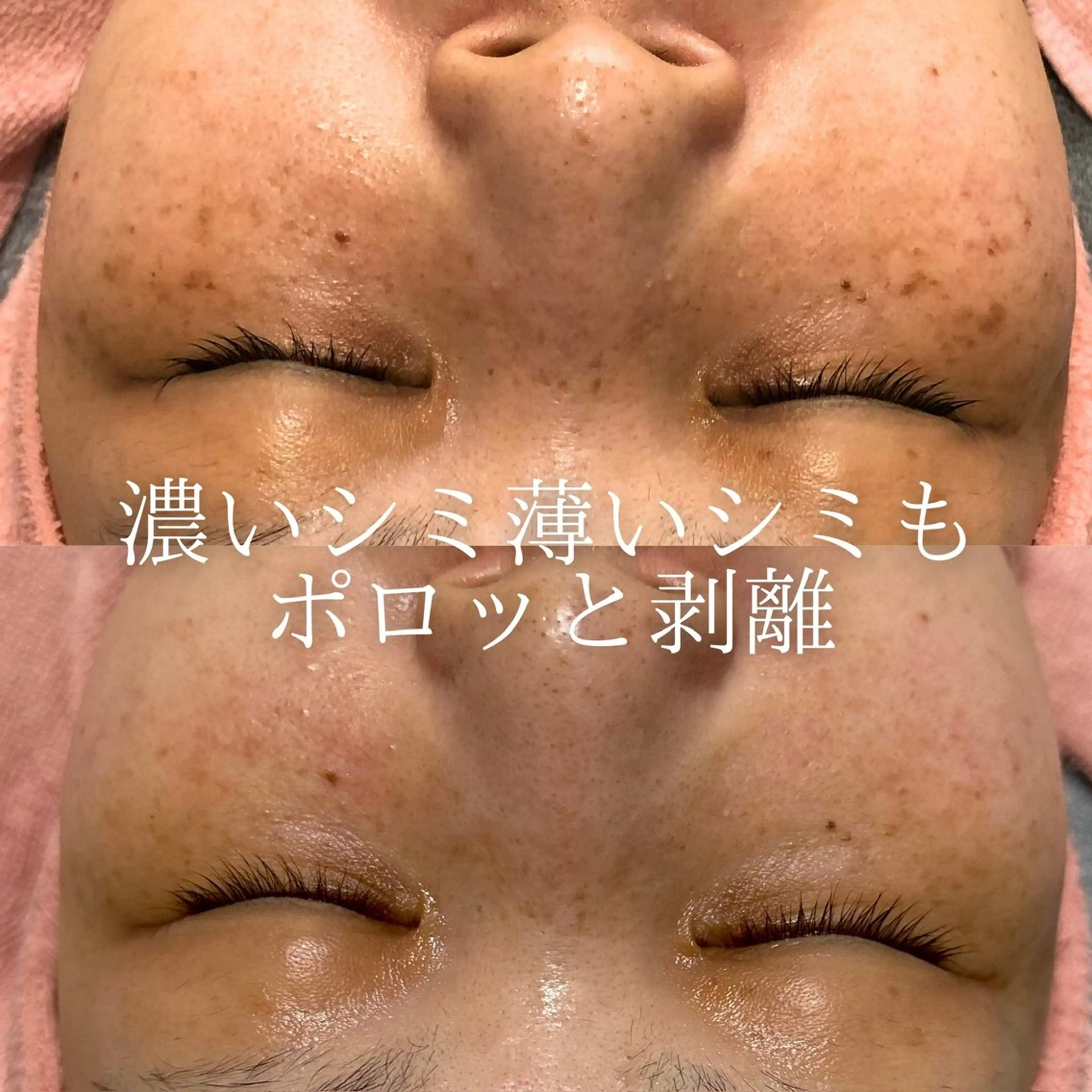 エステ BestBelleꕤ 大阪福島/肌質改善のエステ・リラクイメージ