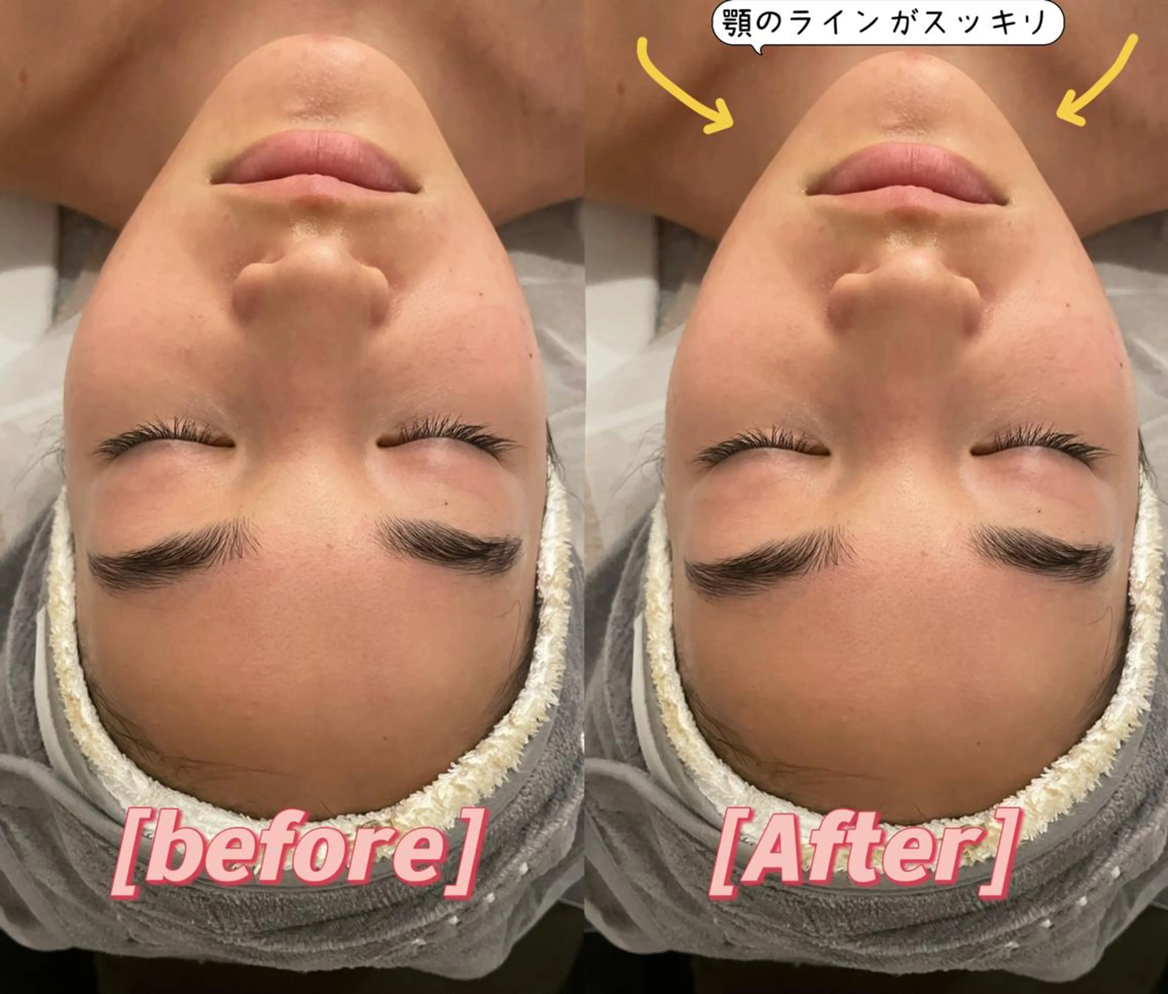 エステ 美肌小顔コルギ&瘦身 KOKOCHIのエステ・リラクイメージ