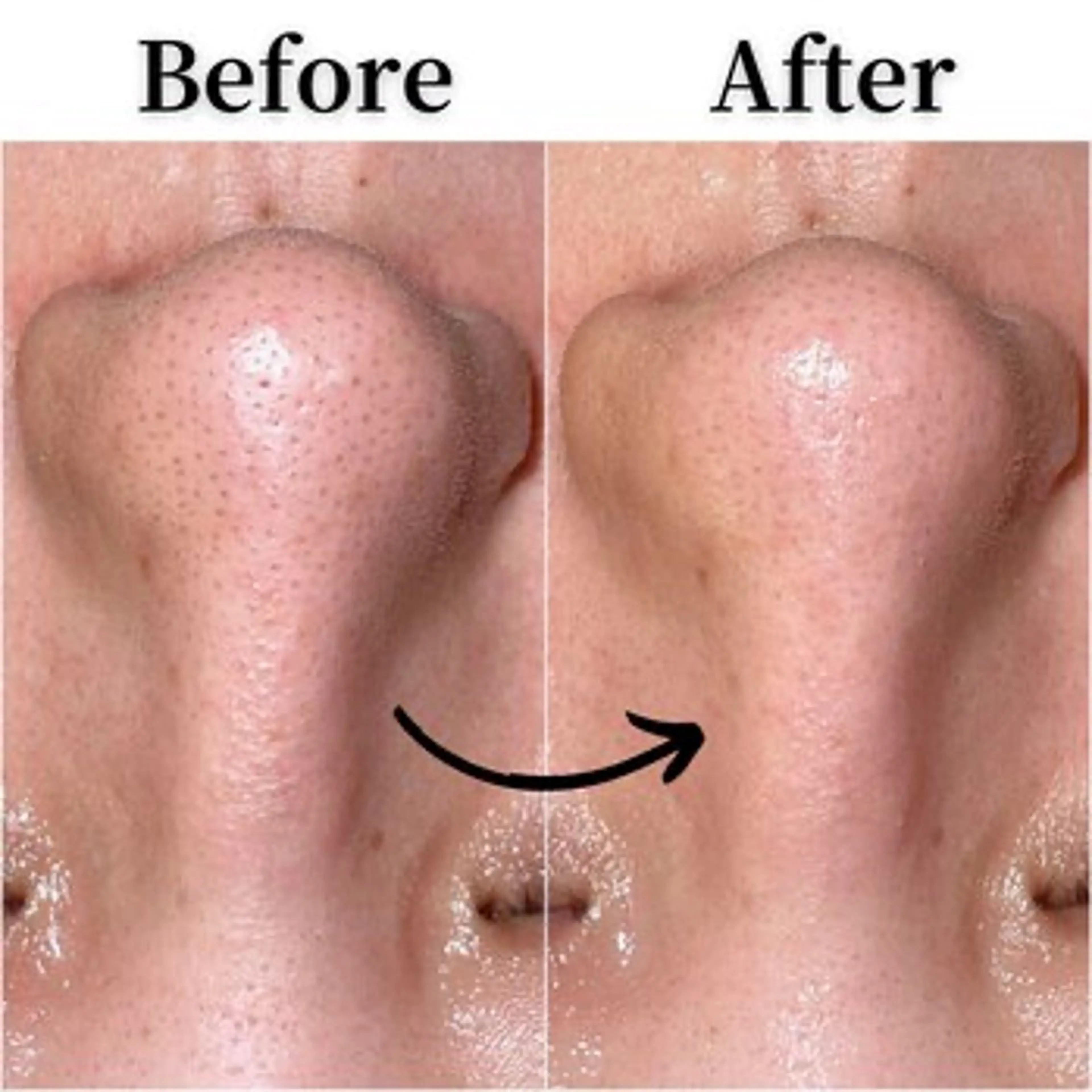 エステ SELF  BEAUTY gracia浦添店所属・gracia 浦添店のその他イメージ