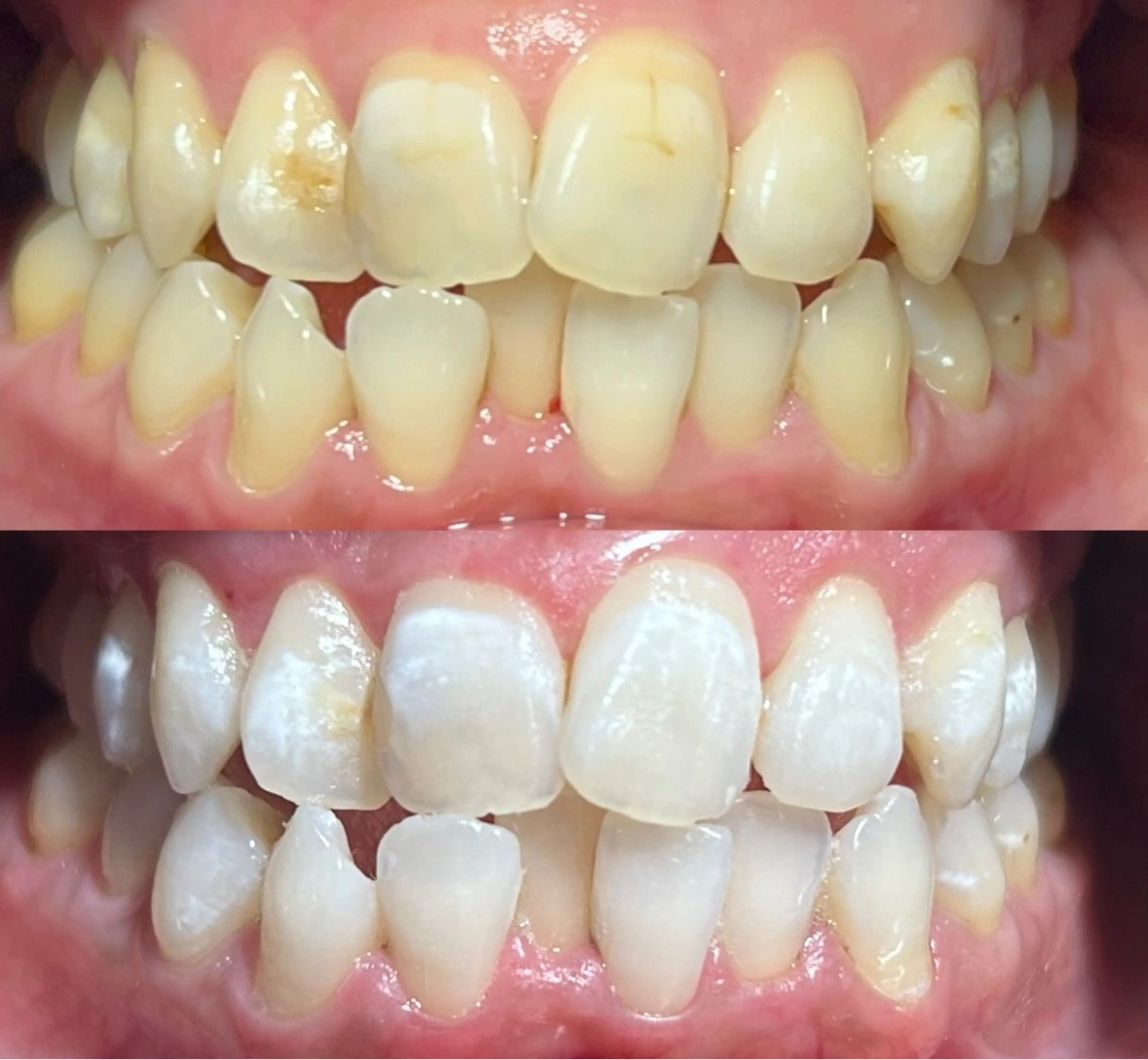 io teeth careのその他イメージ