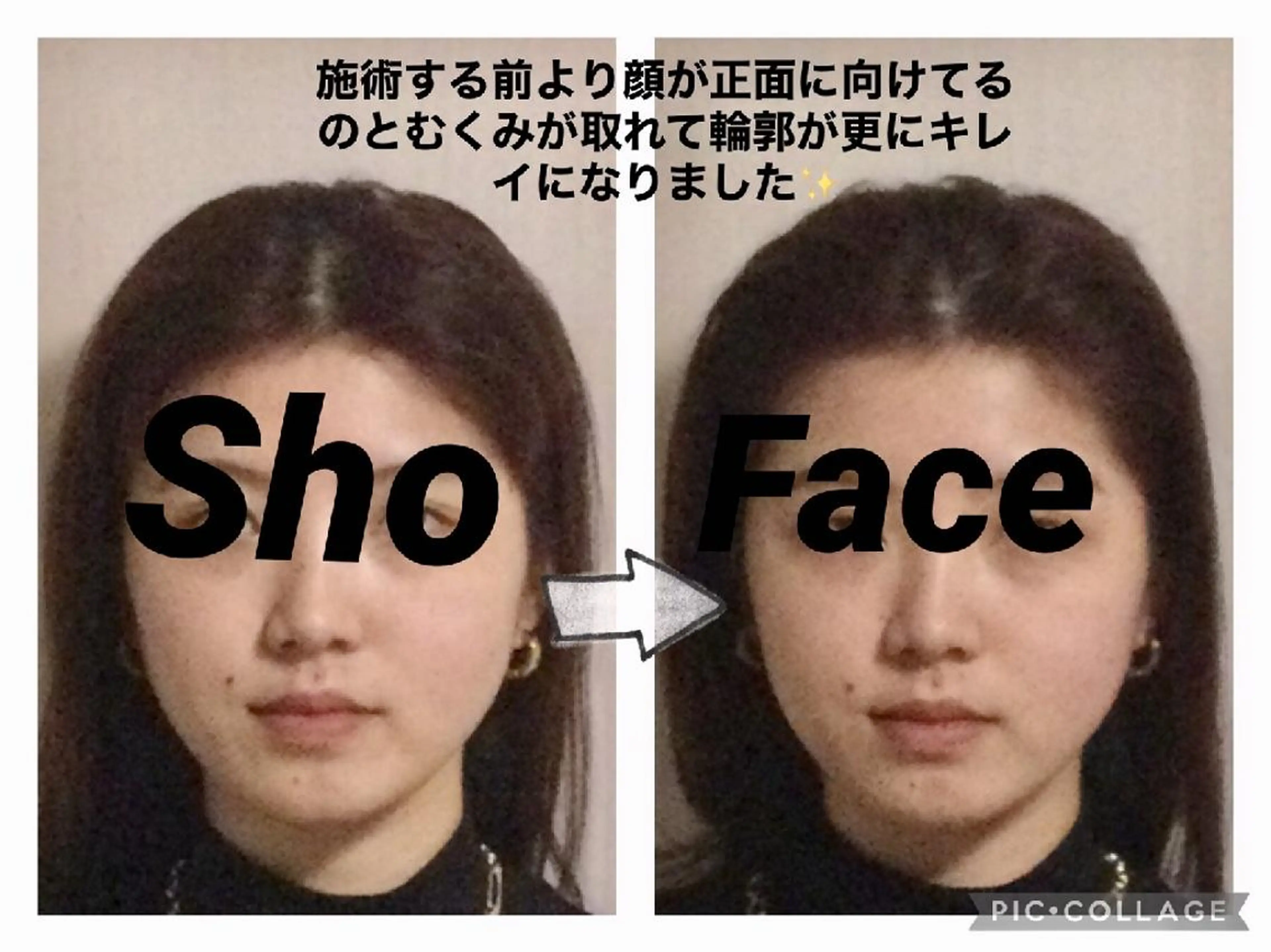 エステ リラク 小顔矯正Sho  FaceDesignのエステ・リラクイメージ