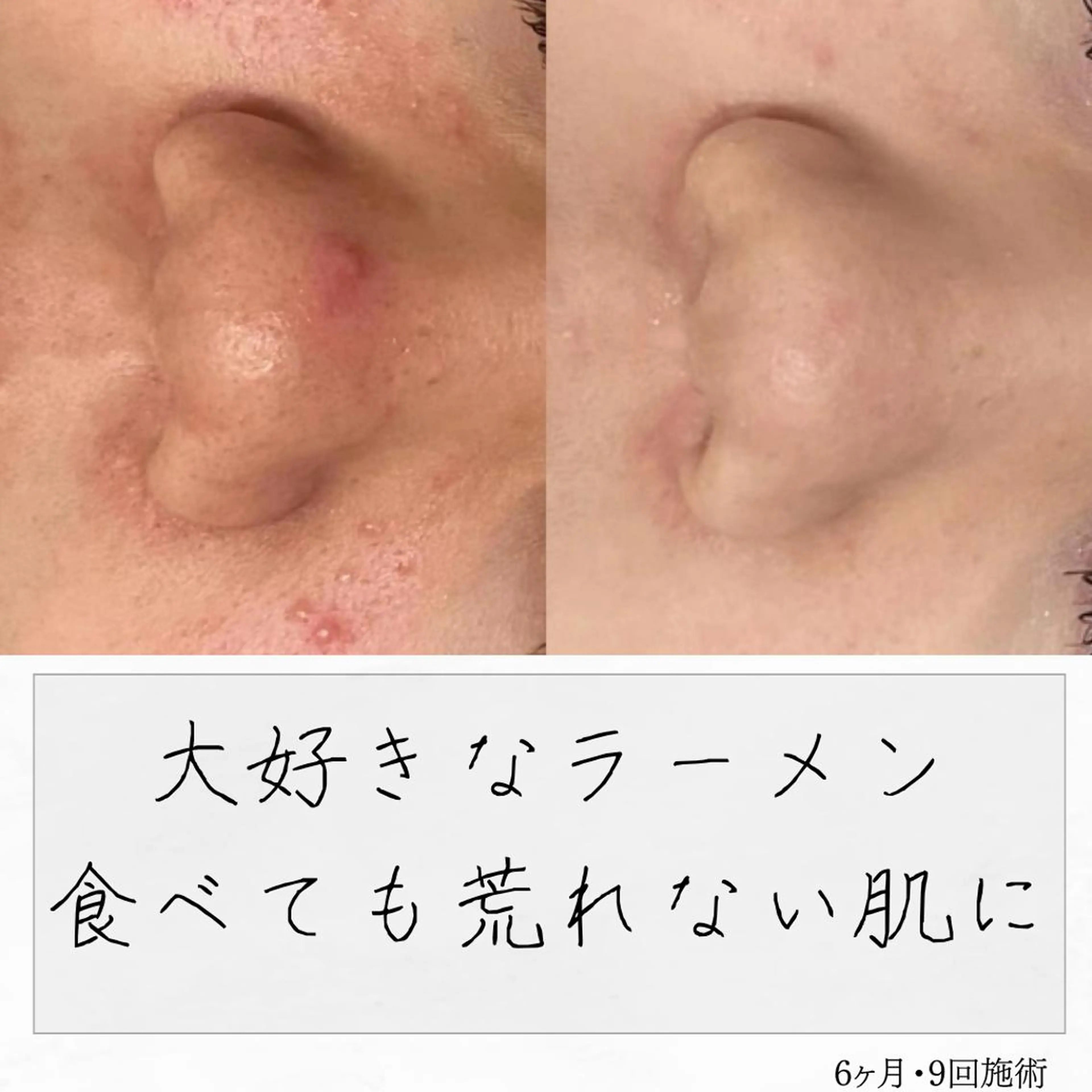 ニキビ経験者が施術 する専門サロン🌻のエステ・リラクイメージ