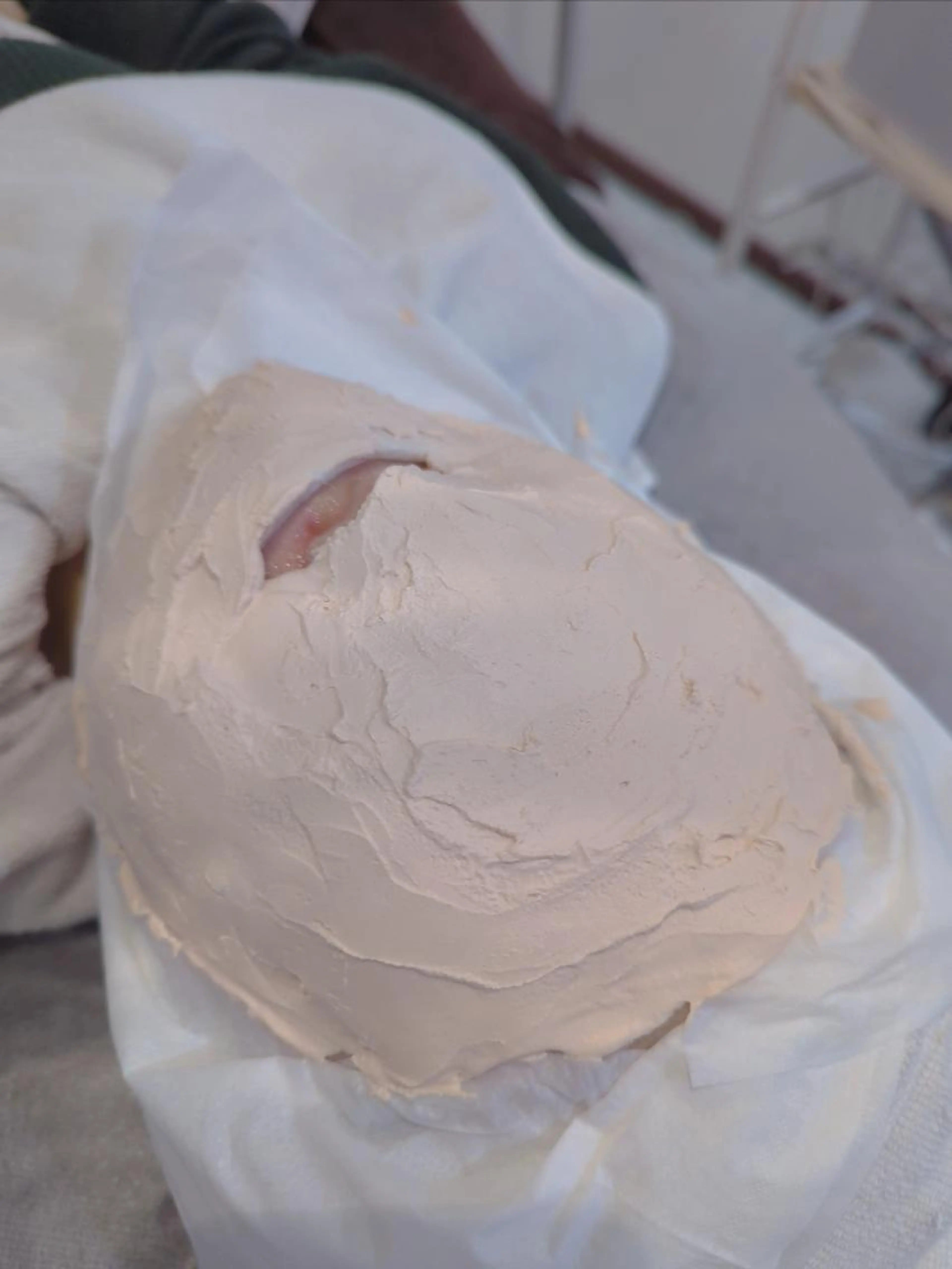 石膏パックの写真