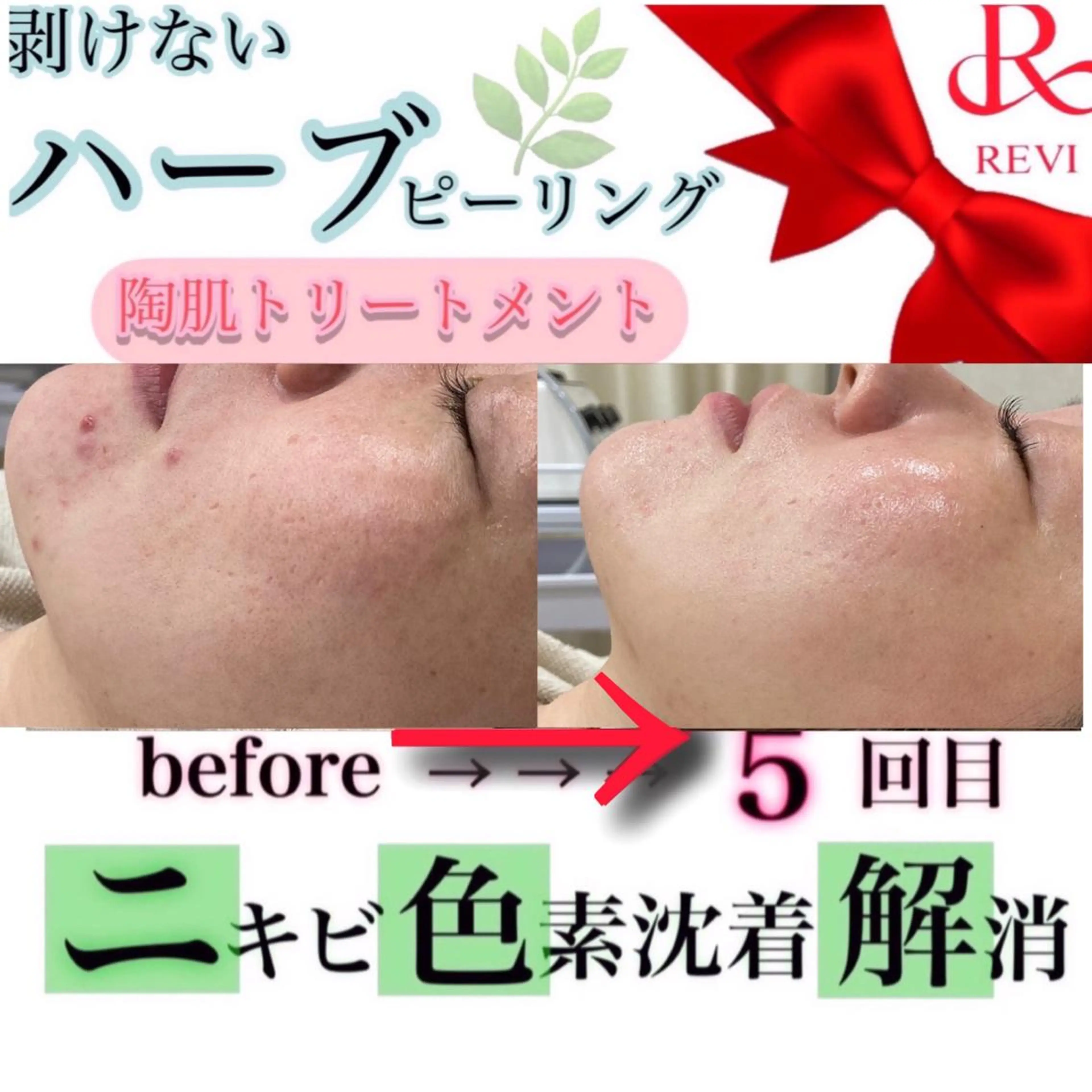 laluna saki...のその他イメージ