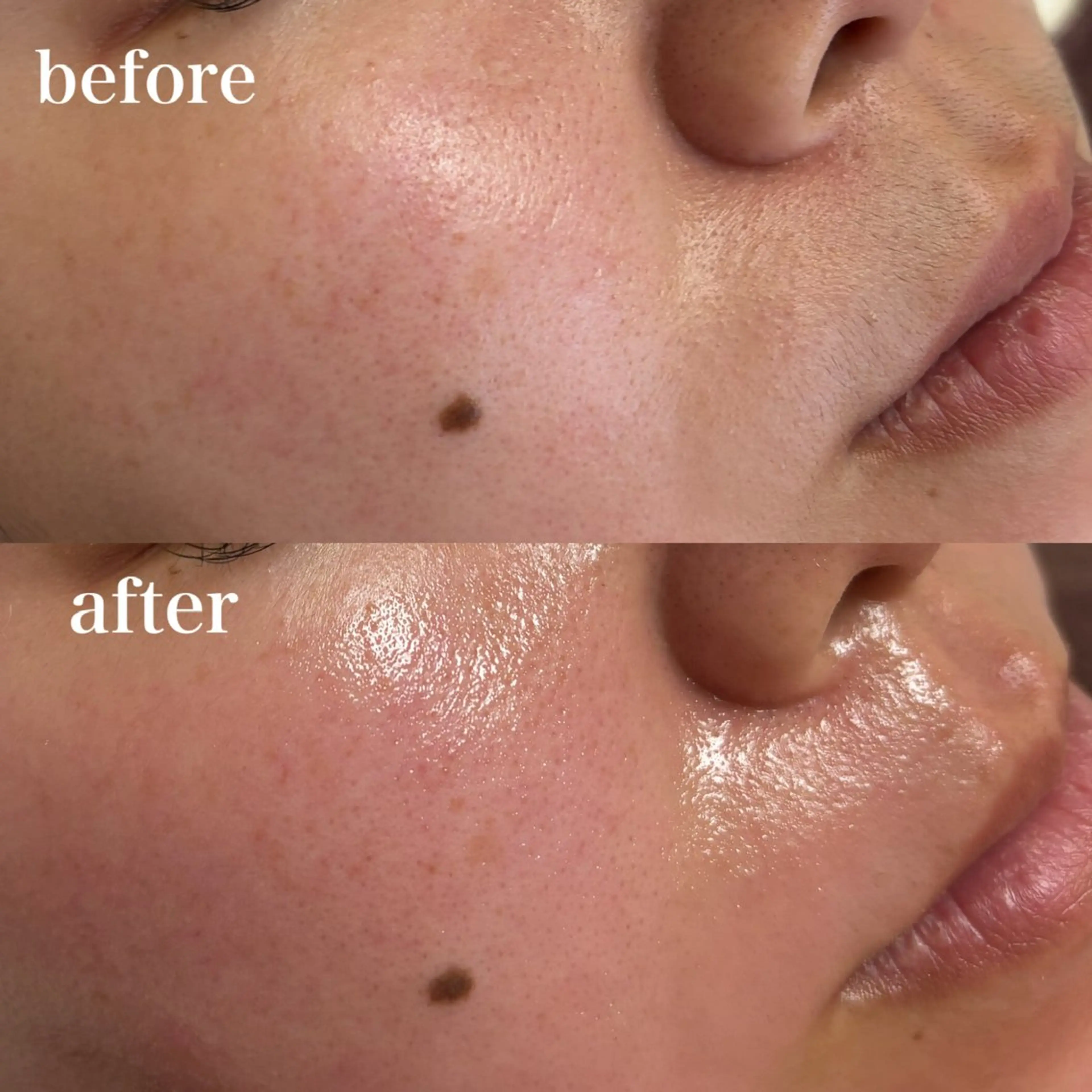 アイブロウ 眉毛ワックス脱毛 脱毛 アイリスト muraの眉毛・アイブロウイメージ