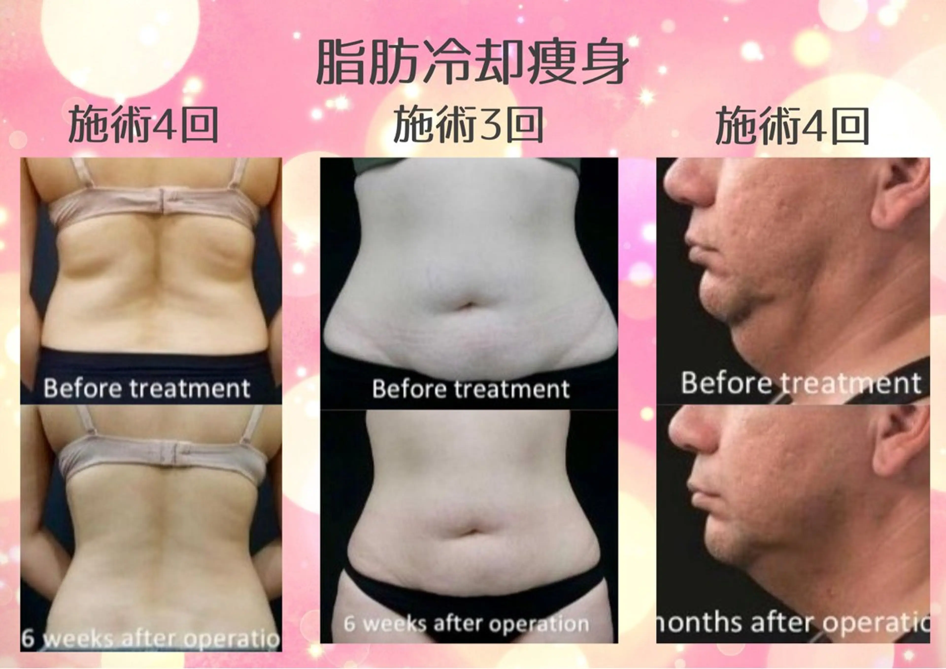 マツエク・マツパ エステ リラク 愛維美水光美肌専門店 メンズレディースokのエステ・リラクイメージ