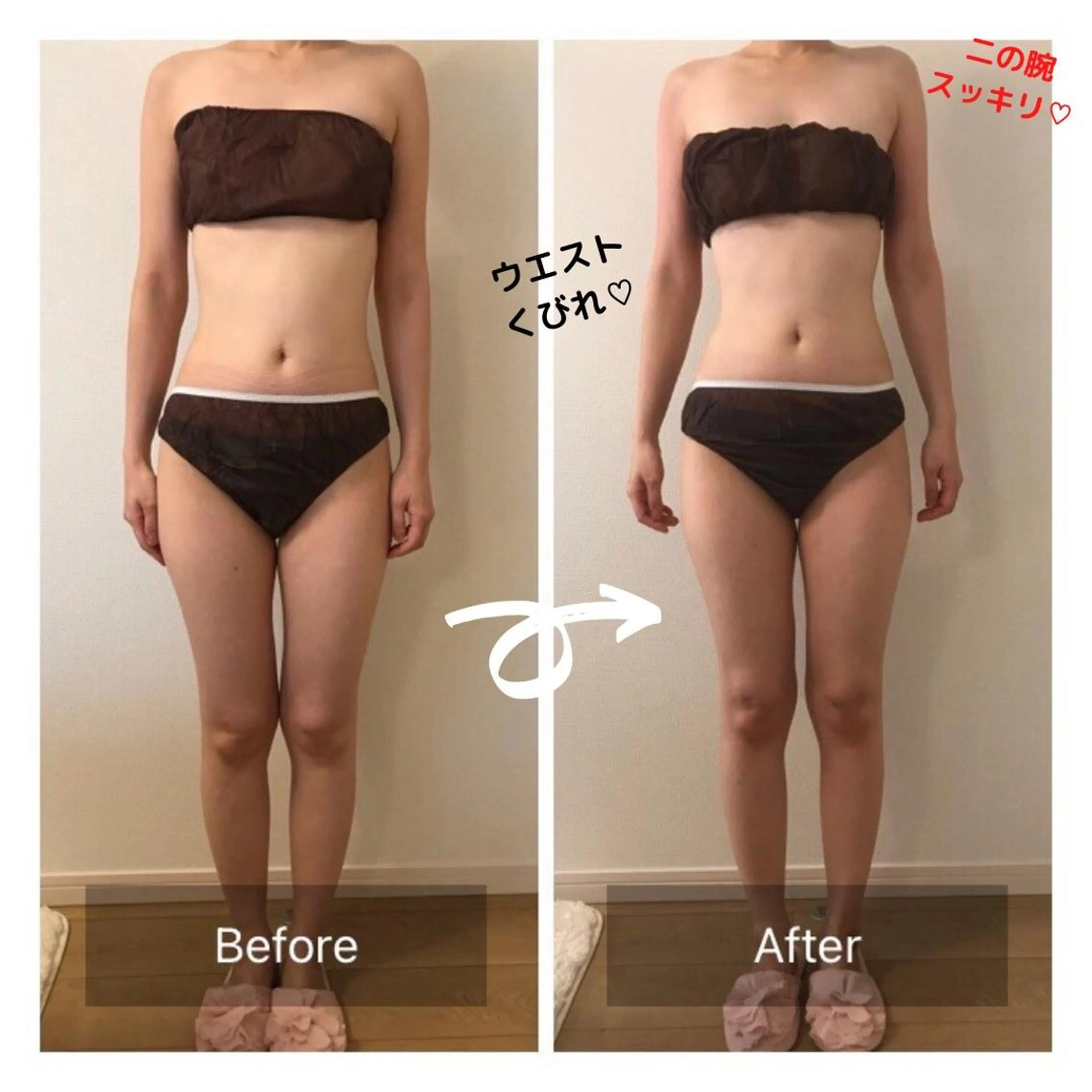 小尻・太もも痩せる パルタージュのエステ・リラクイメージ