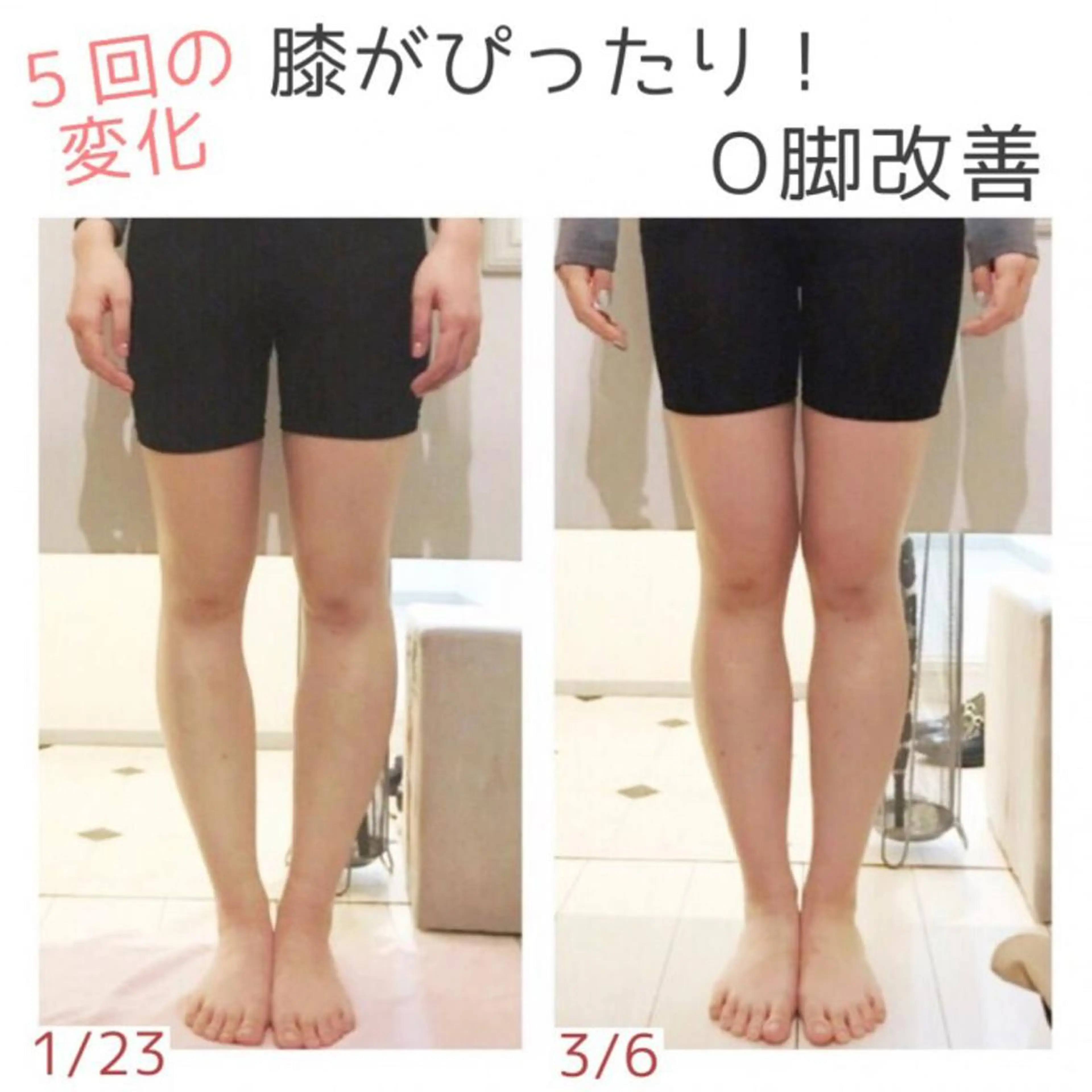 小顔モニター 募集のエステ・リラクイメージ