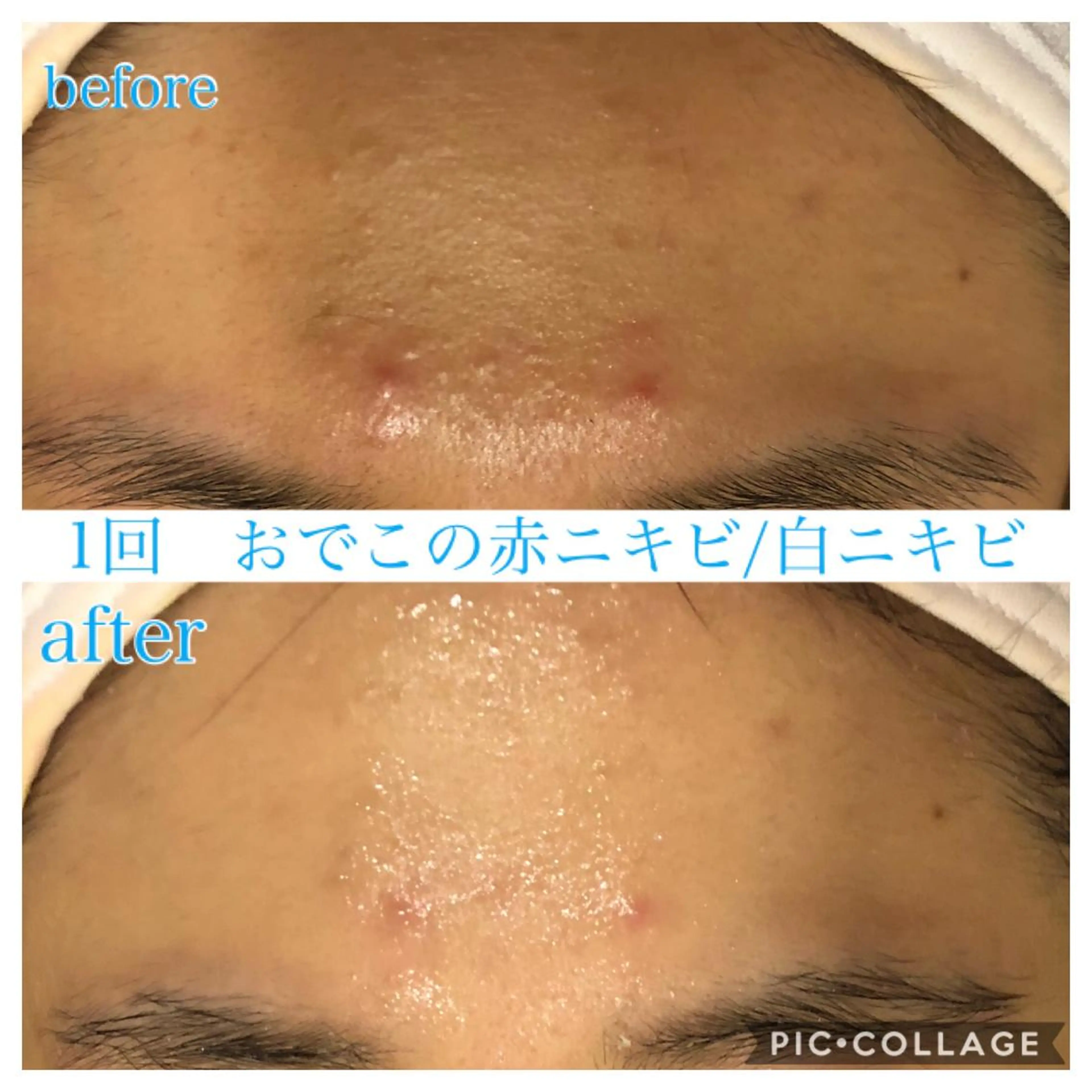 ショート カラー パーマ ヘアアレンジ メンズ キッズ ネイル マツエク・マツパ エステ リラク EnsorClair 代表 野口真央のエステ・リラクイメージ