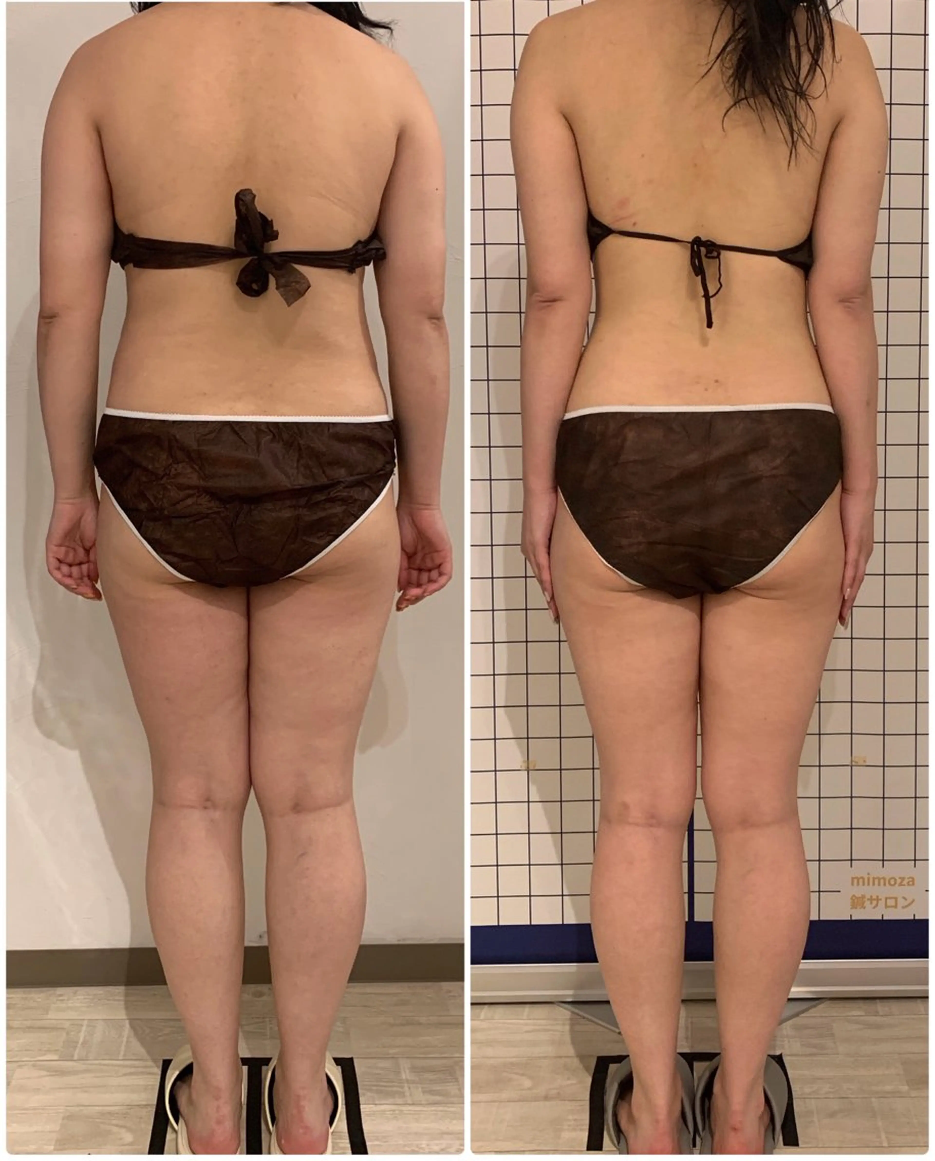 エステ リラク リンパマッサージ mimozaのエステ・リラクイメージ