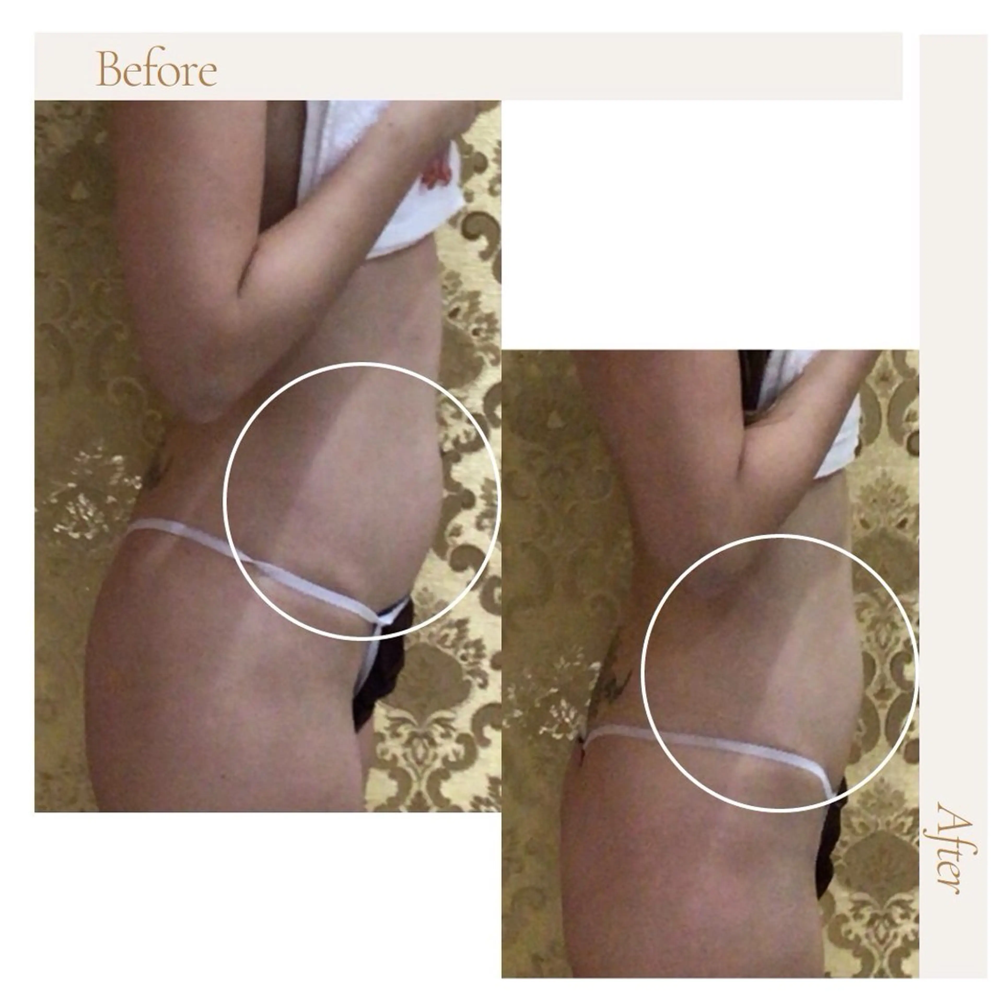 アイアンド ネイルデイのエステ・リラクイメージ