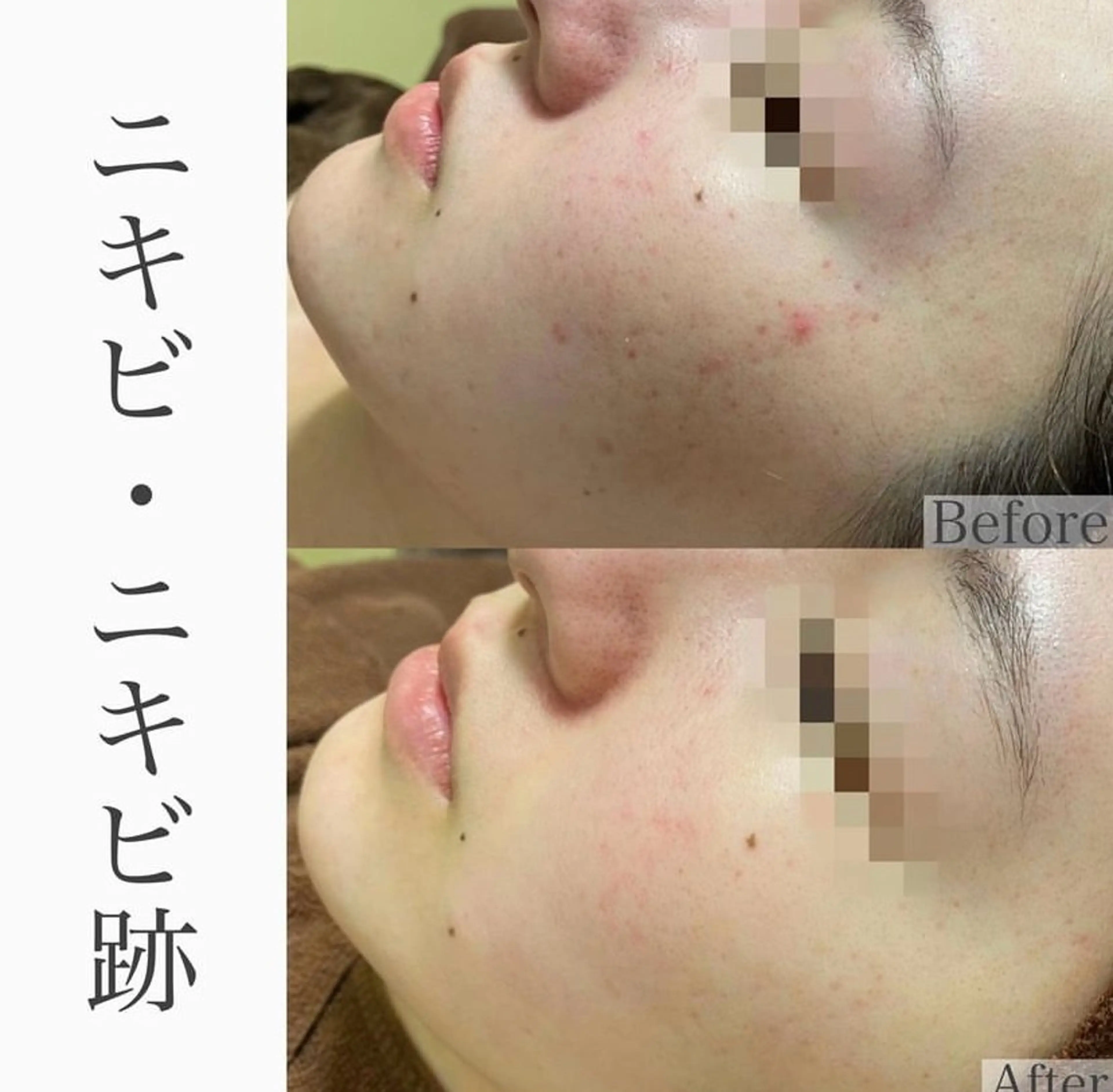 エステ ハーブピーリング専門 BIOPLUS＋川崎のエステ・リラクイメージ