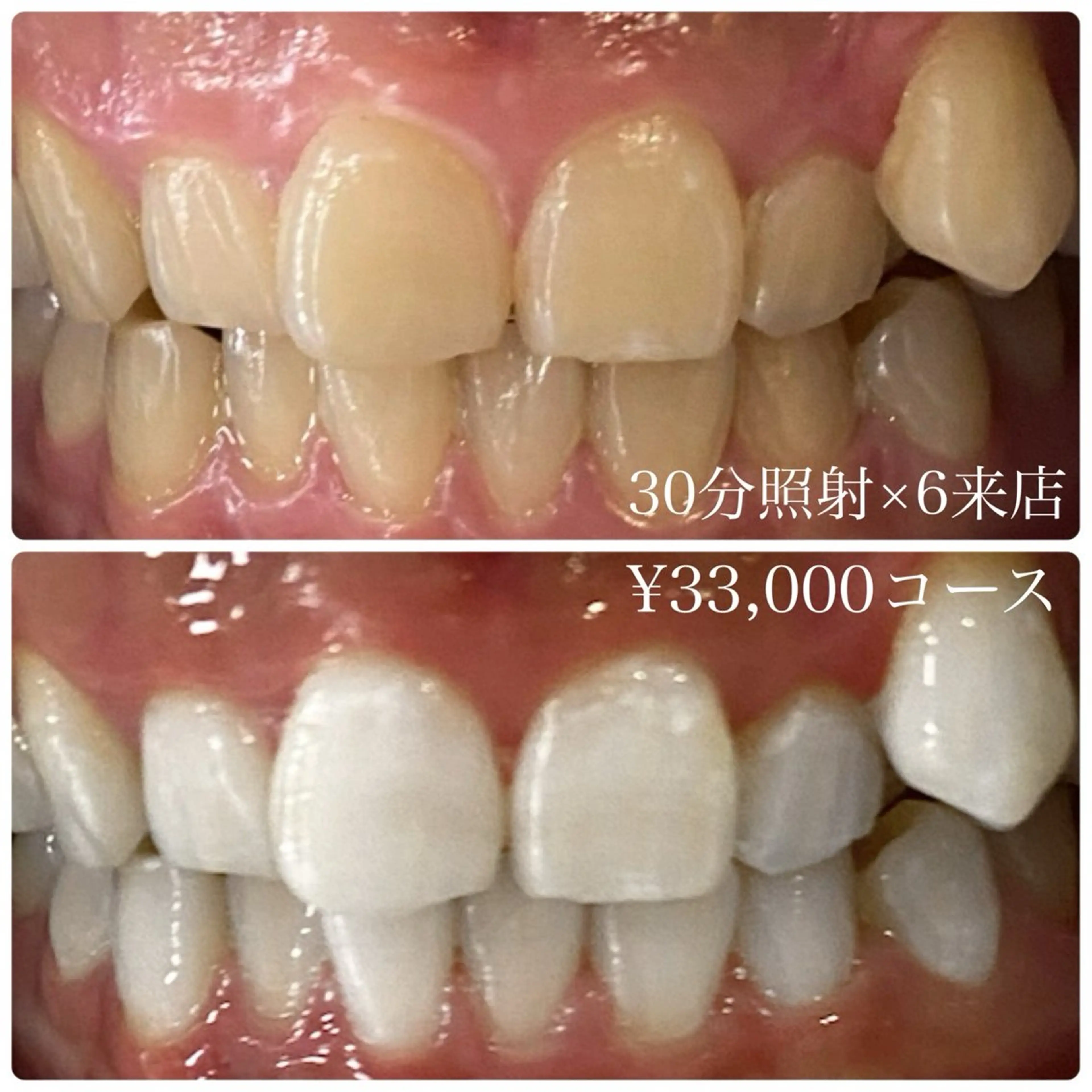 ホワイトニングルーム 横浜店のその他イメージ