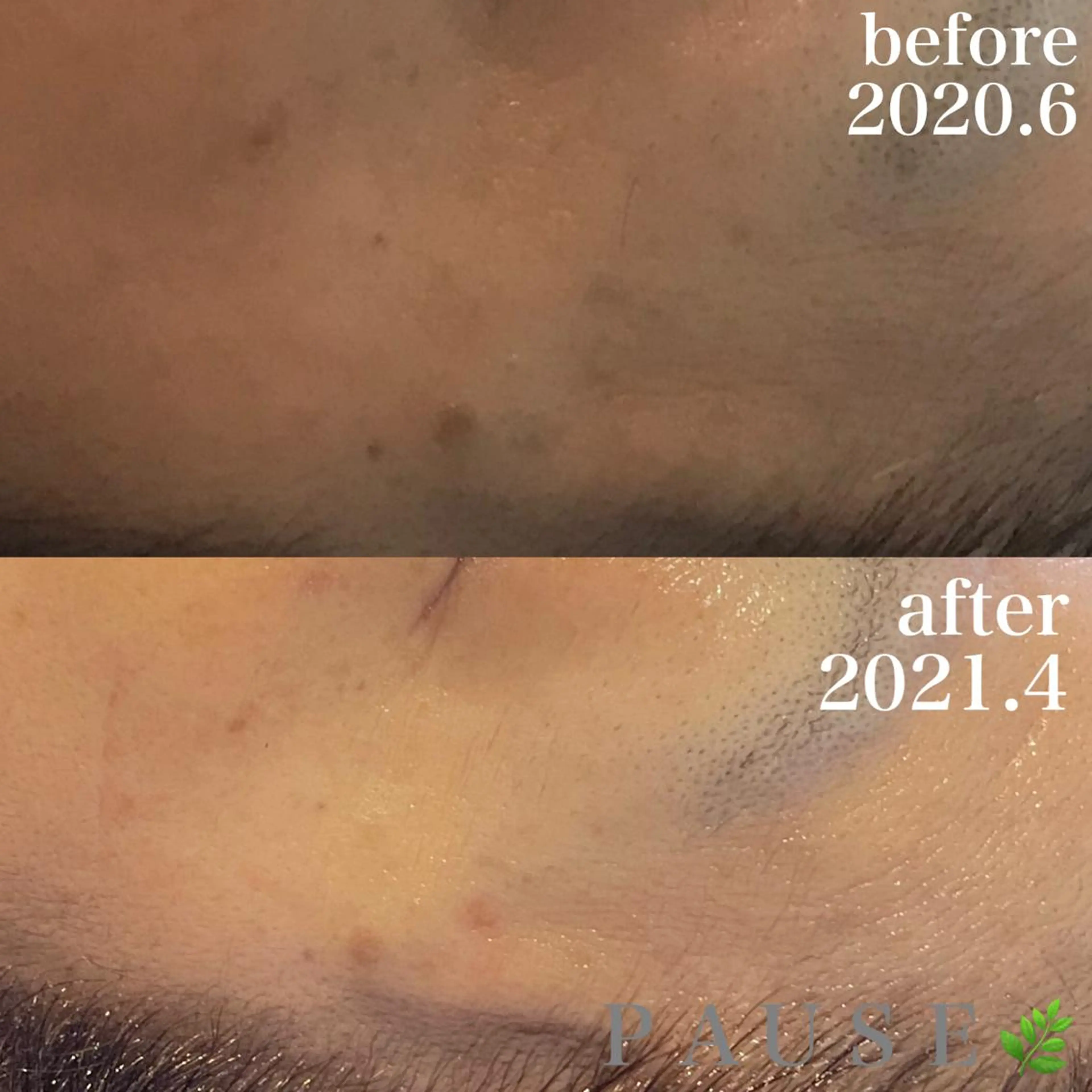 エステ 浜野 恵美のエステ・リラクイメージ