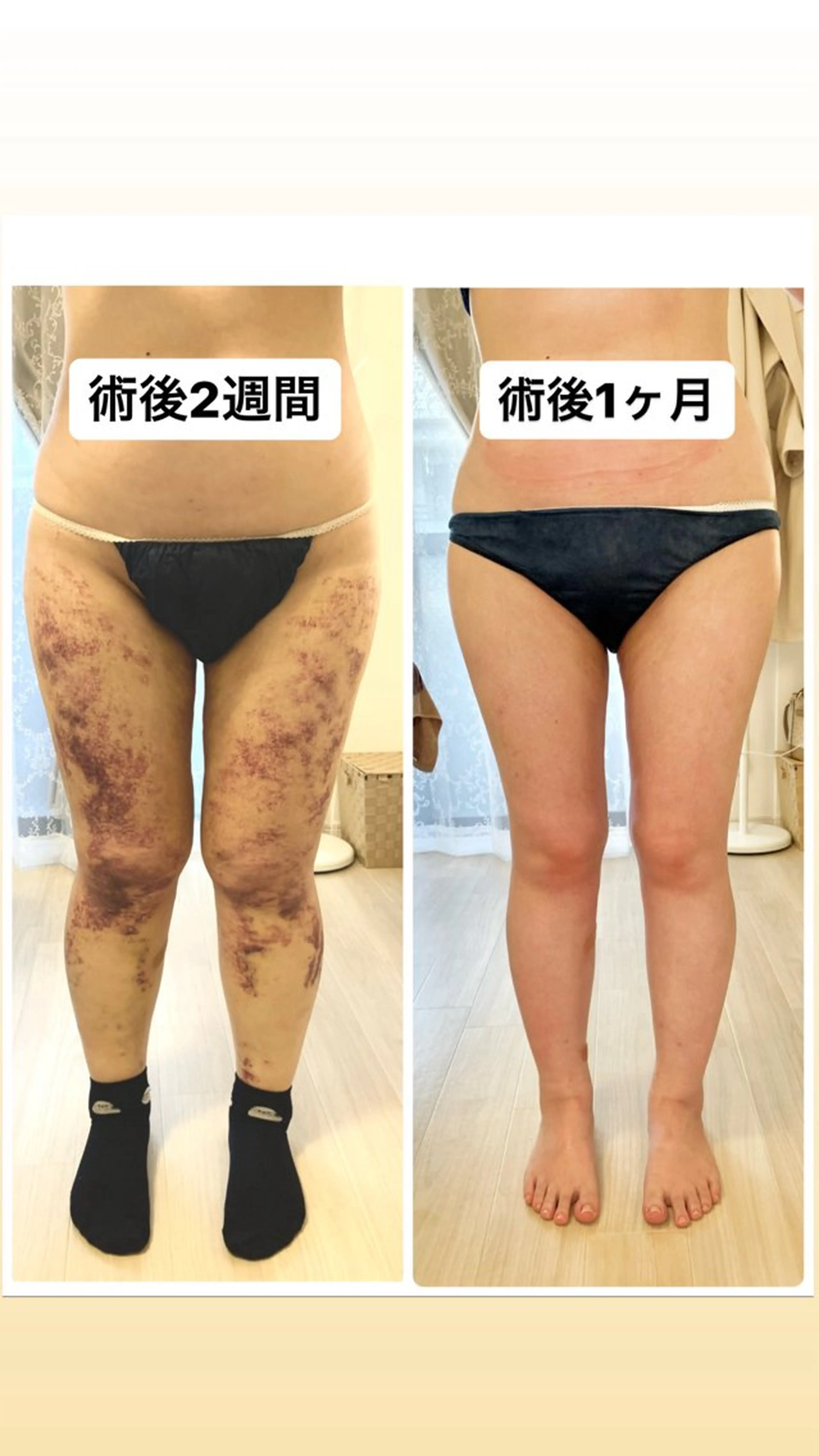 エステ メディカル インディバサロン同心のエステ・リラクイメージ