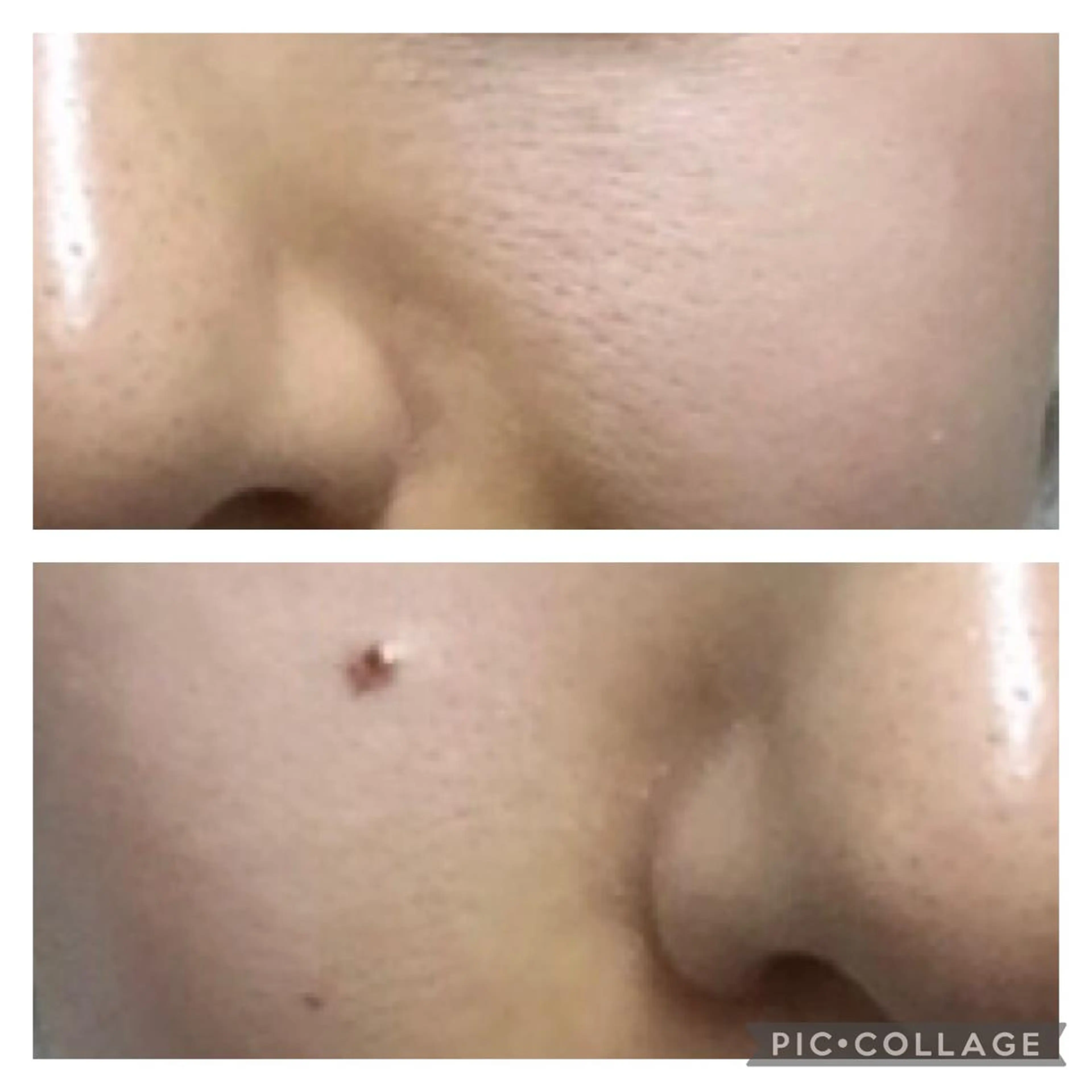 ❇︎毛穴の汚れ、ザラツキさよならコース 50分（希望者はメイクまで可能）の写真