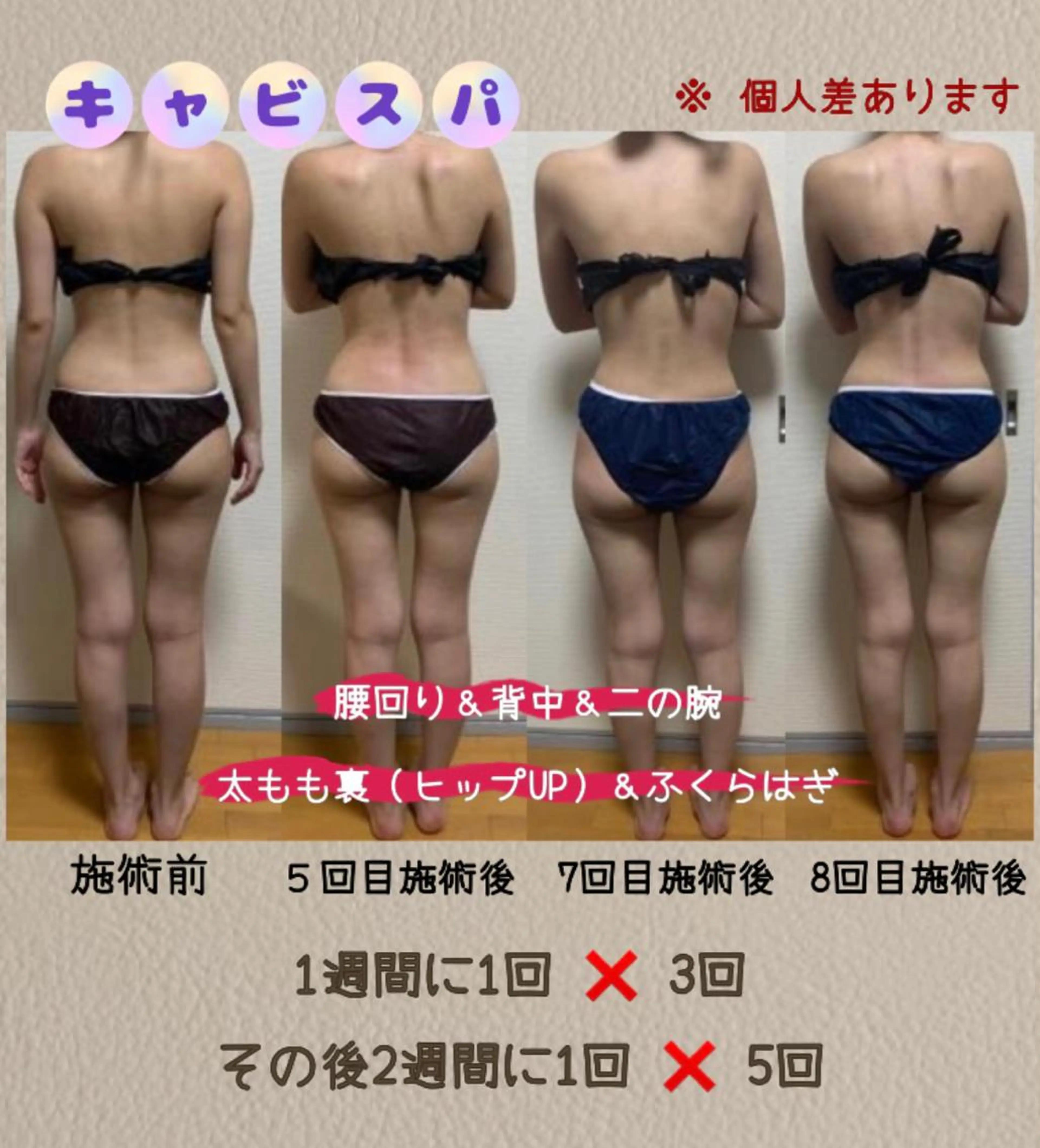 エステ ヴィーナス ビューティーのエステ・リラクイメージ