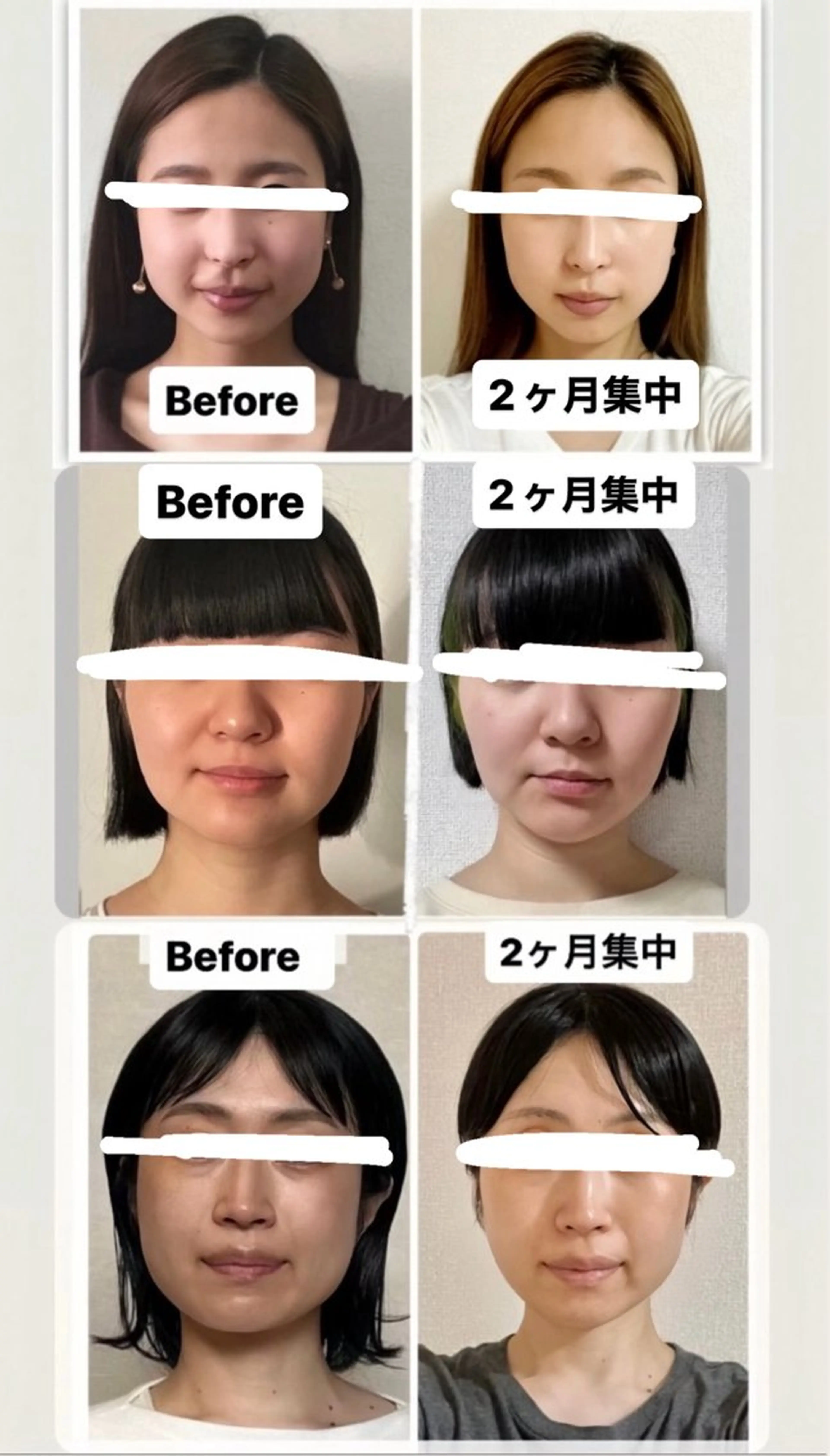【2ヶ月で自分史上最高の小顔へ到達★】2ヶ月短期集中通いコースの写真