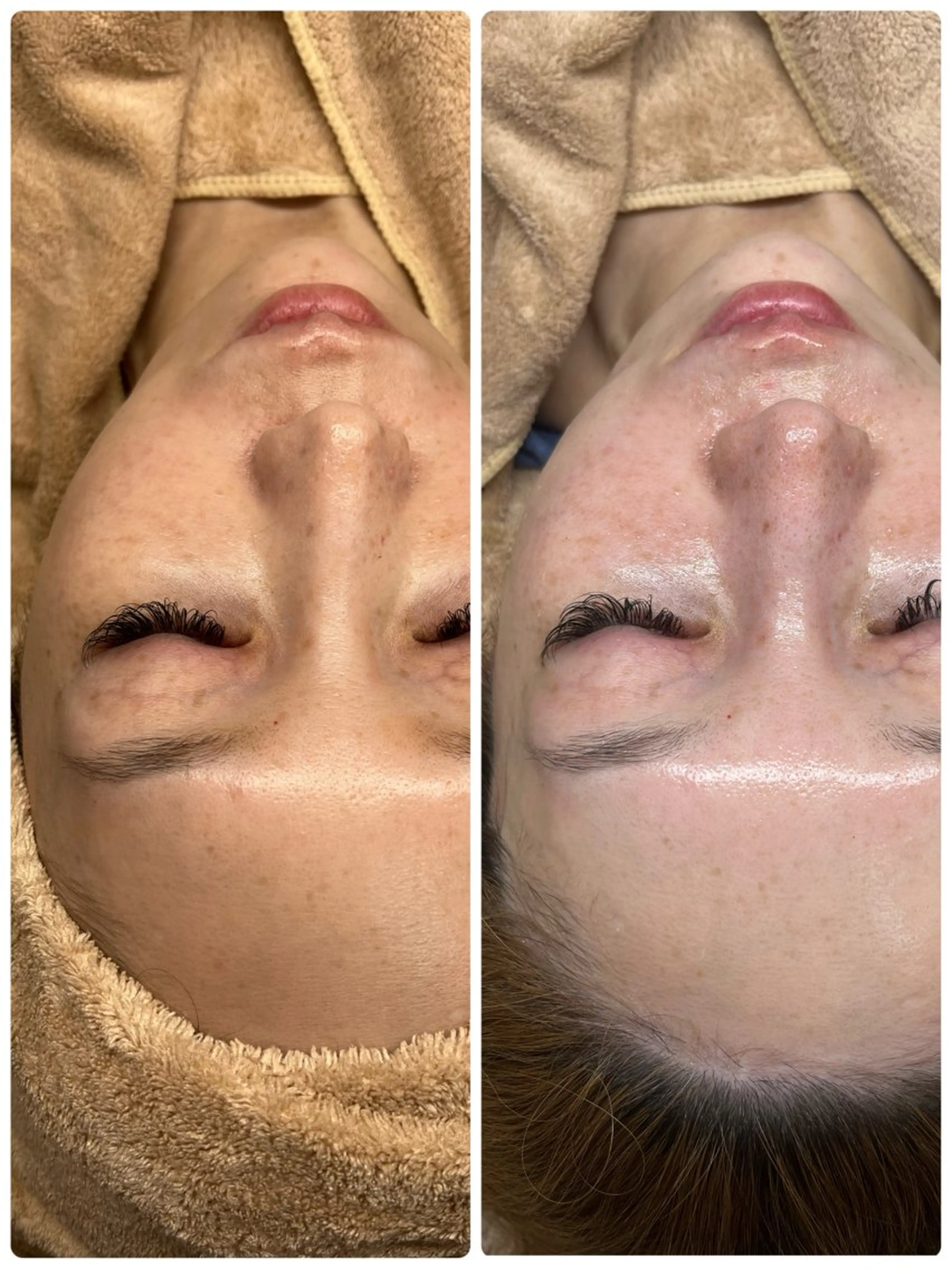 肌に自信のない人 専門サロンのエステ・リラクイメージ