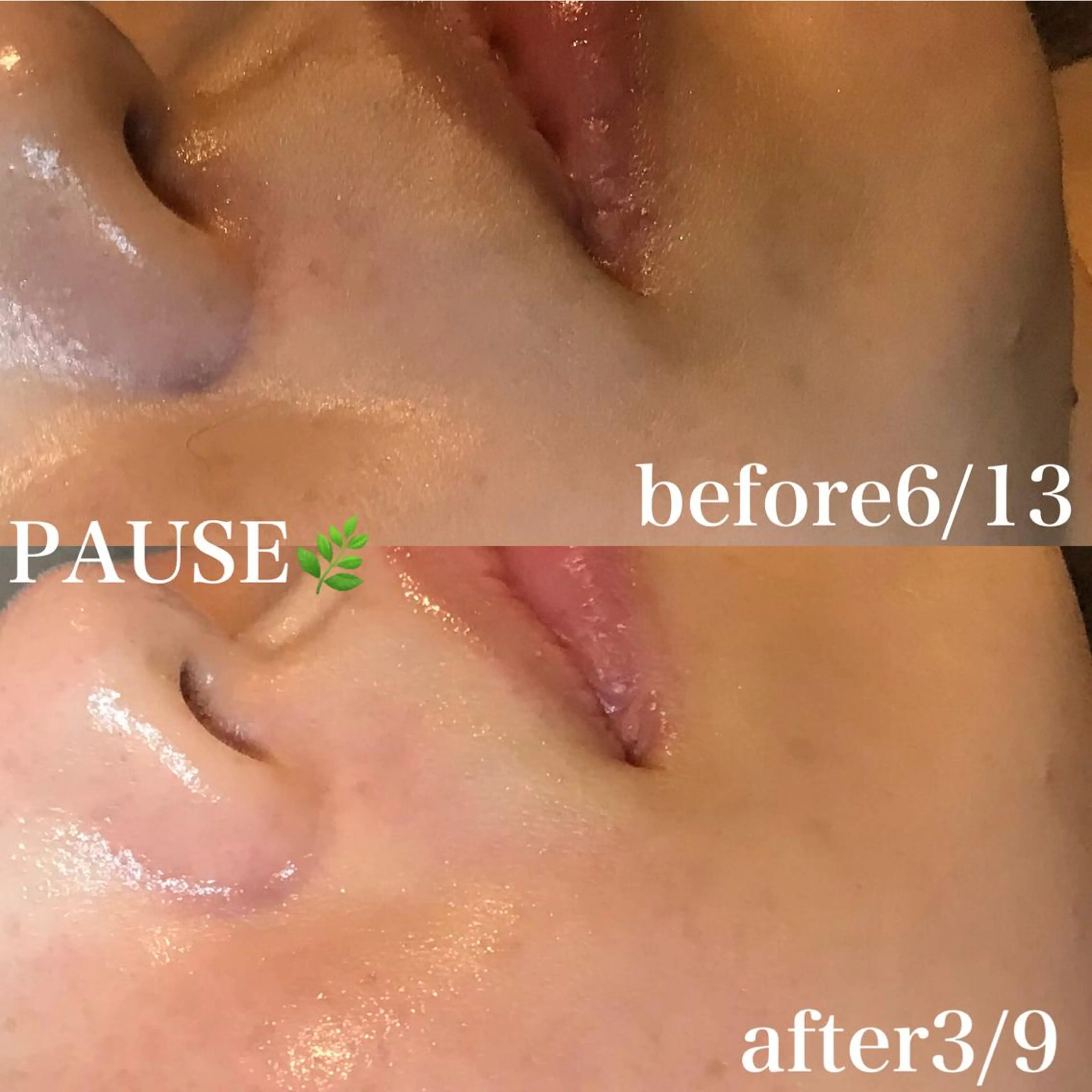 エステ 浜野 恵美のエステ・リラクイメージ