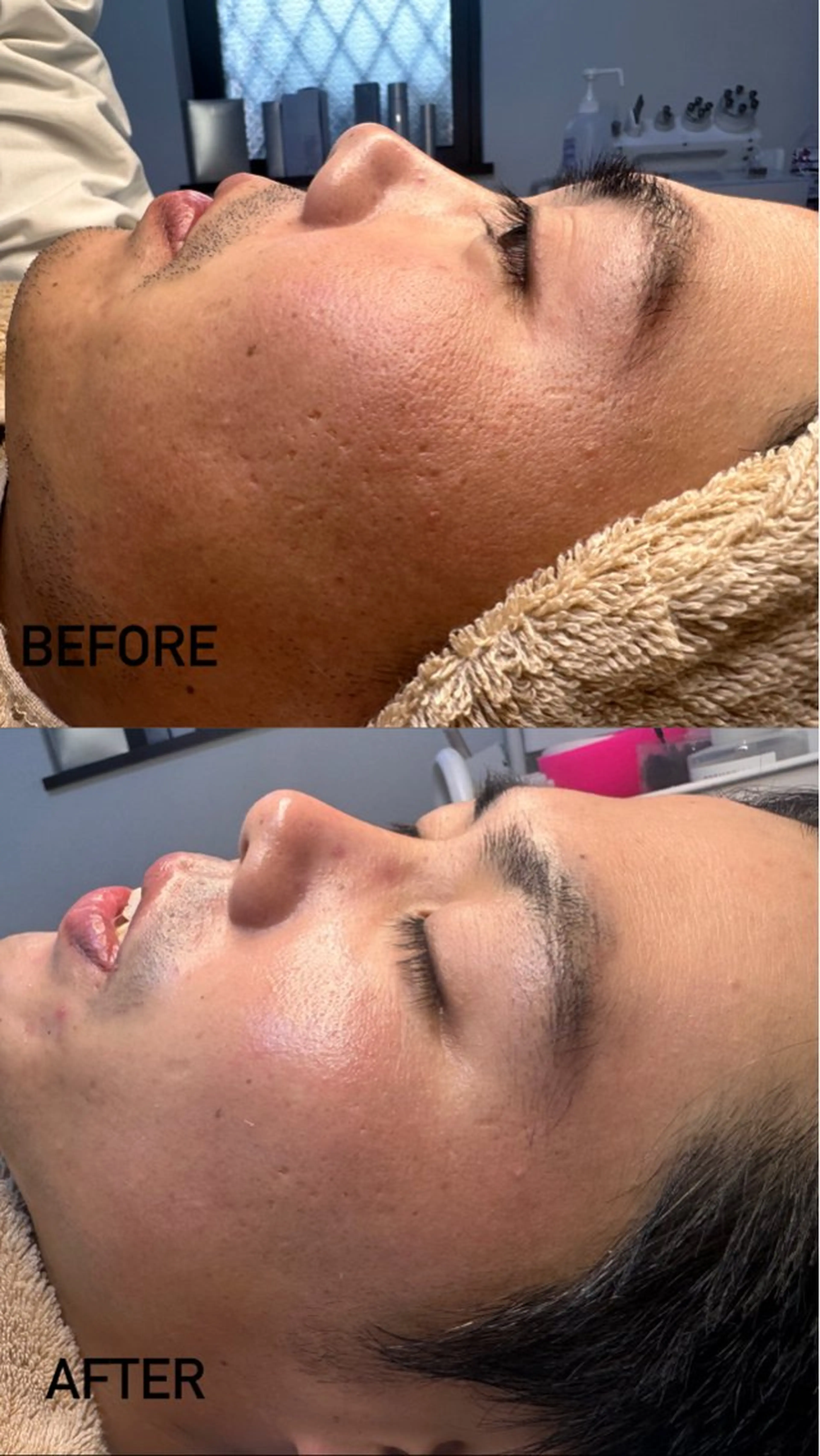 エステ 田中 りののエステ・リラクイメージ