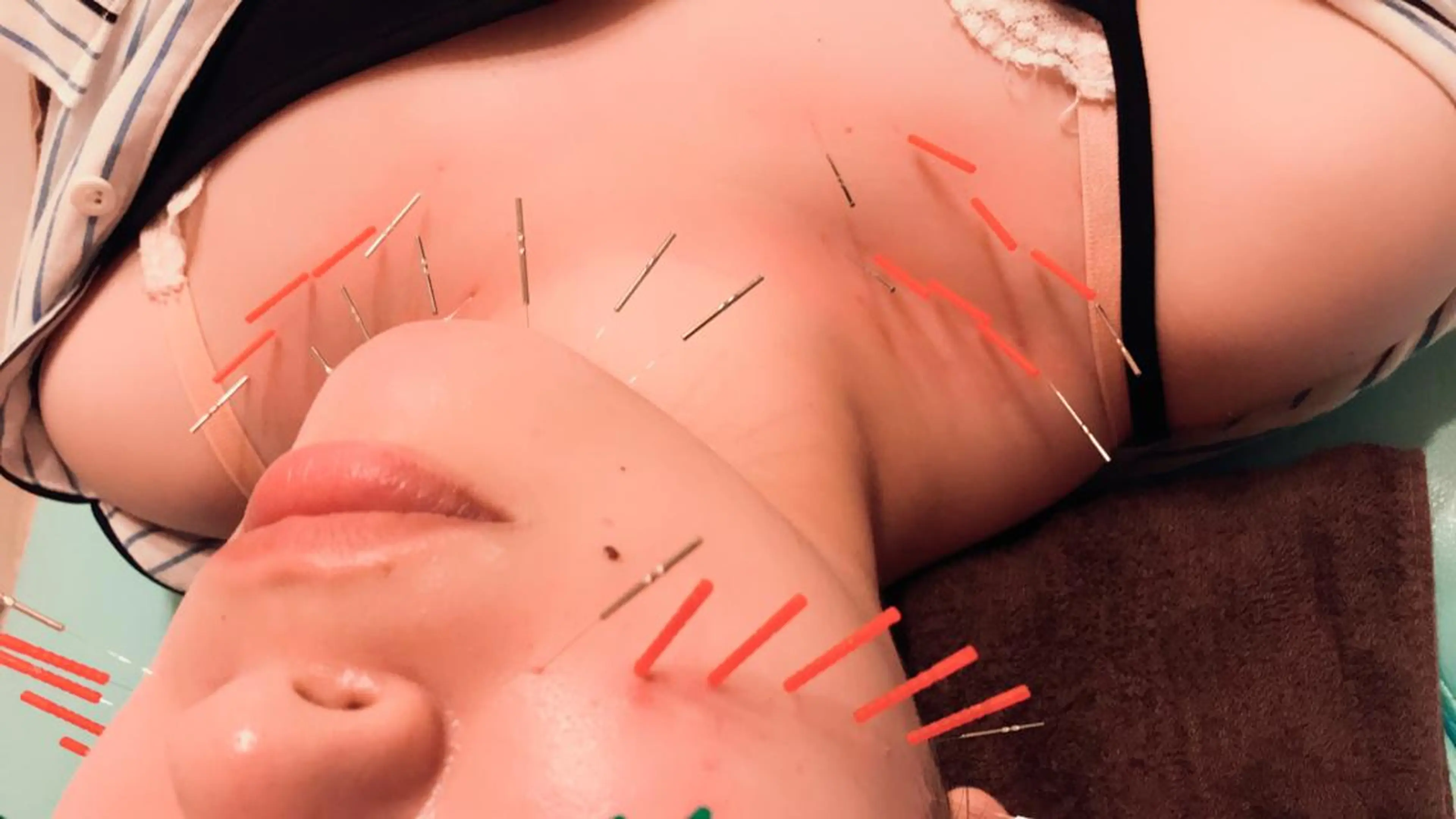 はりすたいる 鍼灸院のエステ・リラクイメージ