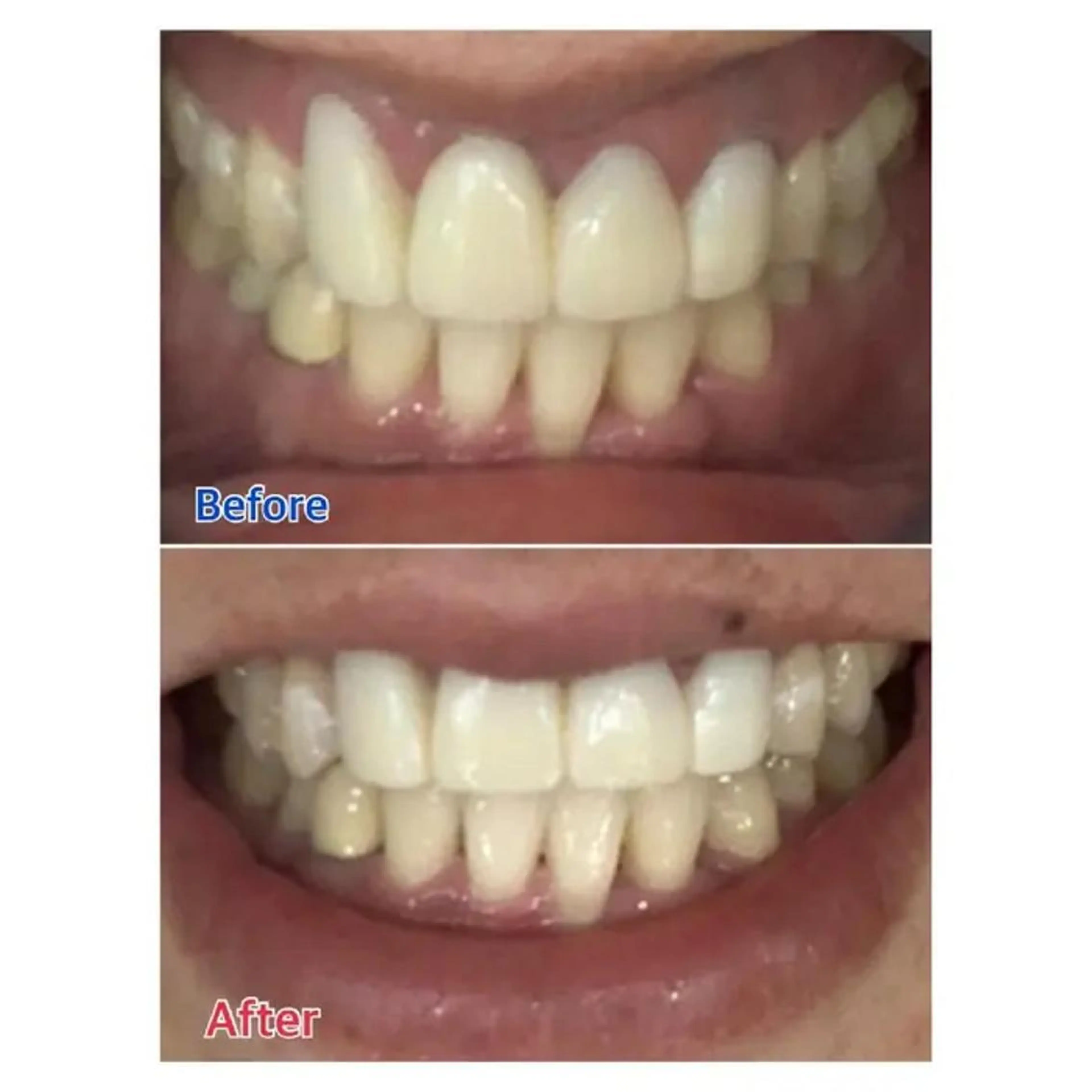 M渋谷 ホワイトニングのエステ・リラクイメージ